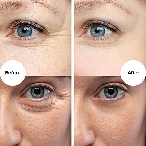 Gle Skincare: Anti-Wrinkle Moisturizer with Vitamin E, Algae, Niacinamide & B5
