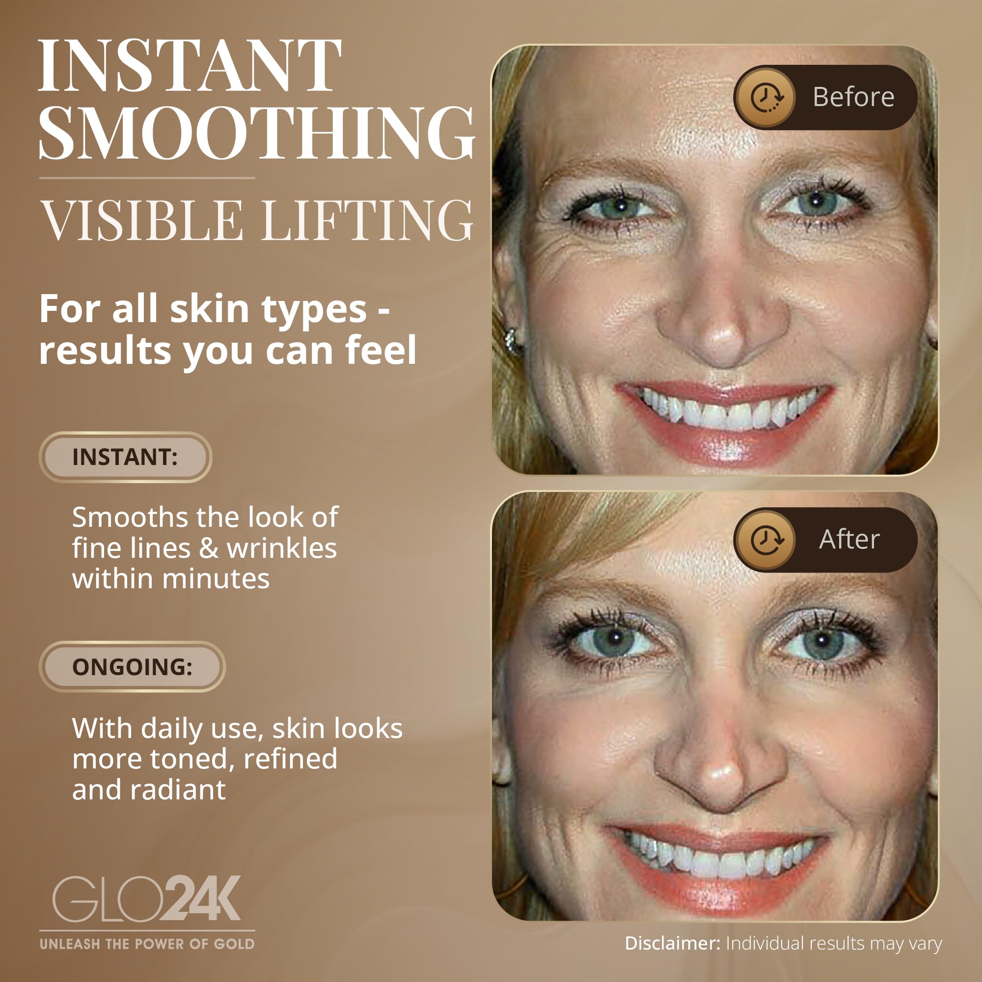 GLO24K Instant Wrinkle Filler & Lifting Cream XL 1.2 oz