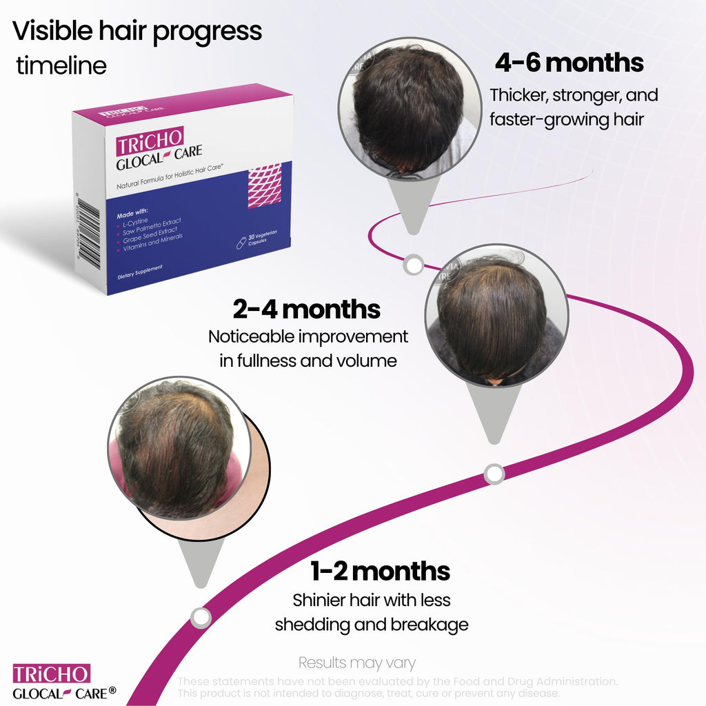 GlocalCare Tricho – Hair Growth Supplement with Saw Palmetto & Biotin 5000mcg