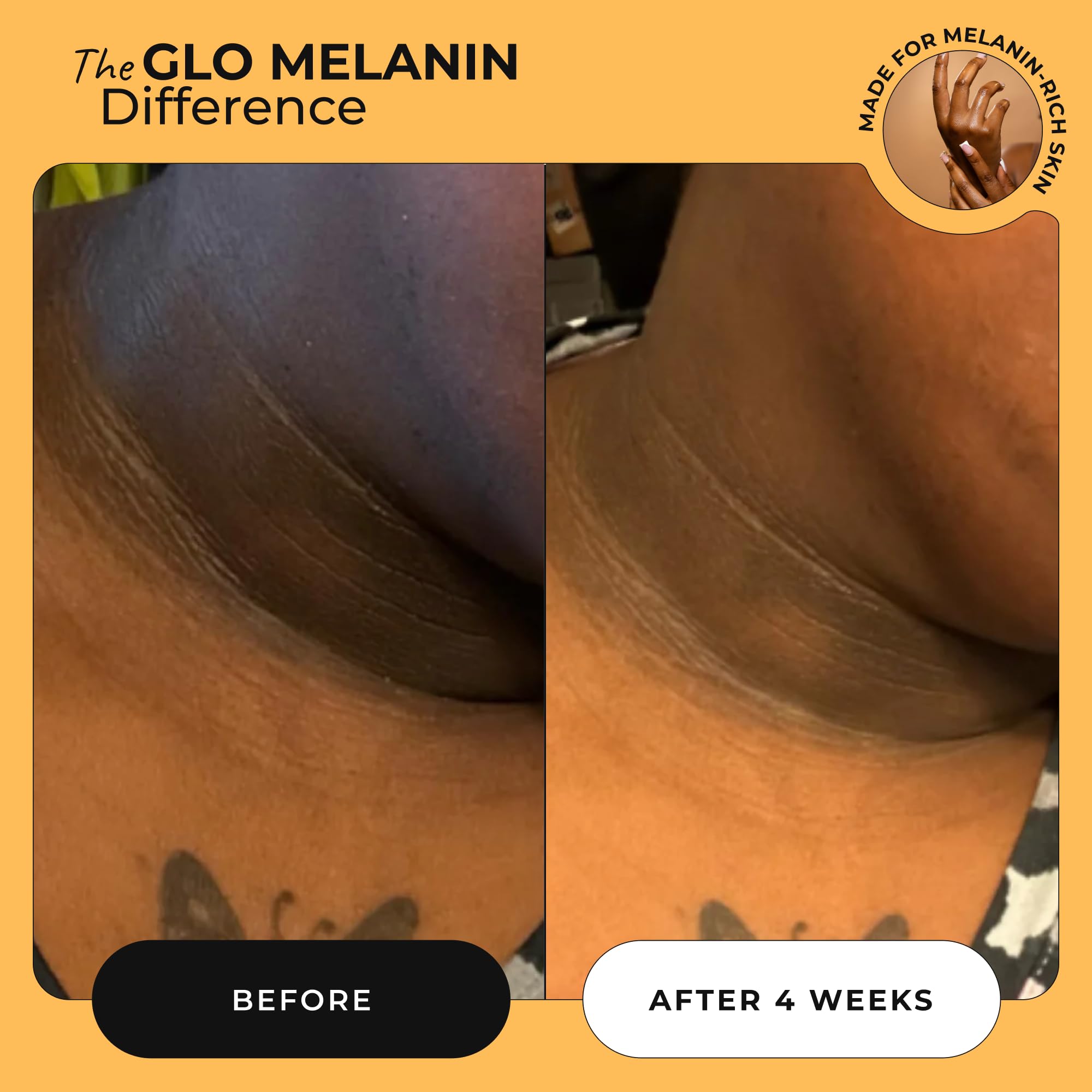 Glo Melanin Magic Eraser Dark Spot Cream – Face & Body 1.7 oz