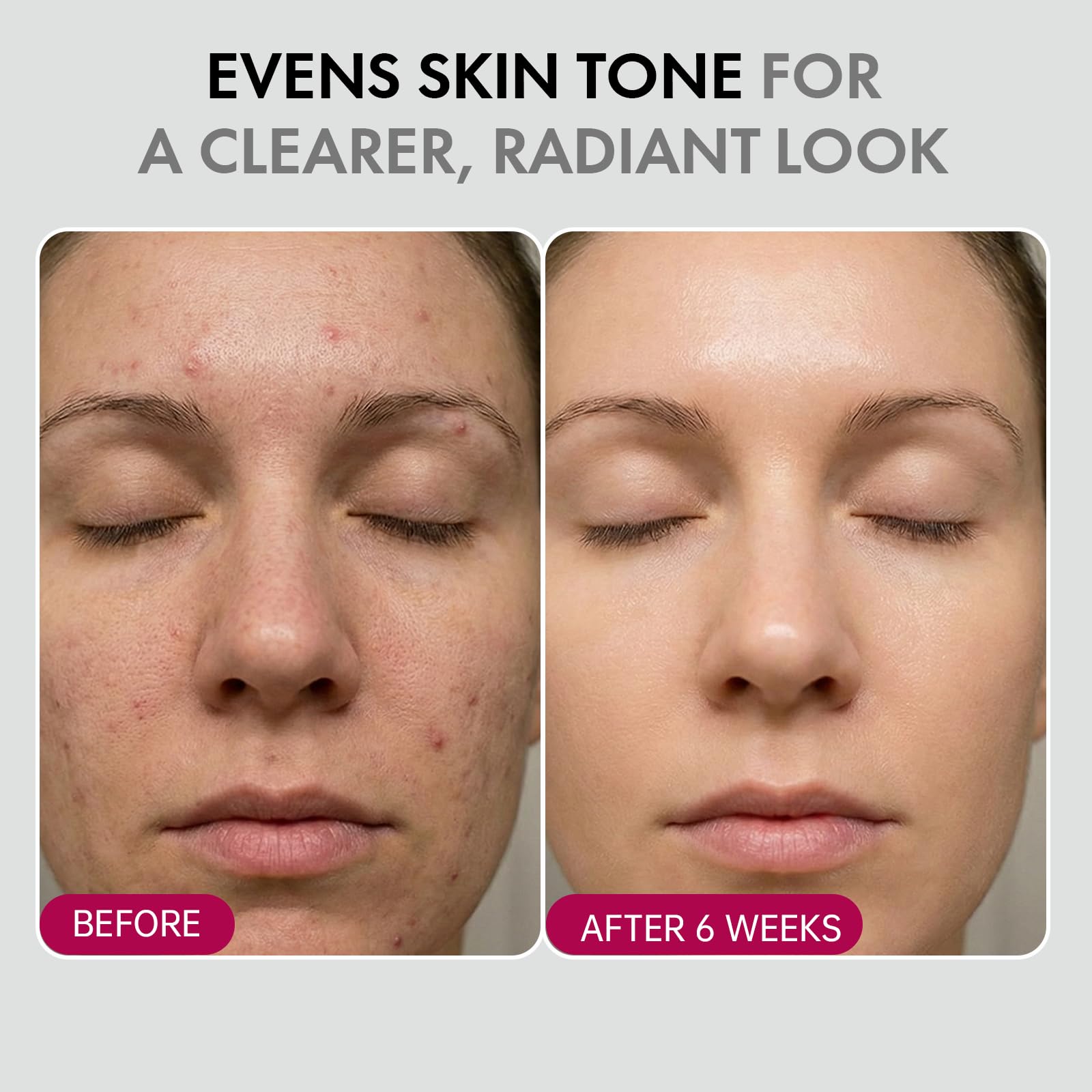 Glopink 2Pcs Arbutin 7% + Tranexamic Acid 4% Cream – Niacinamide Brightening Hydrating Moisturizer