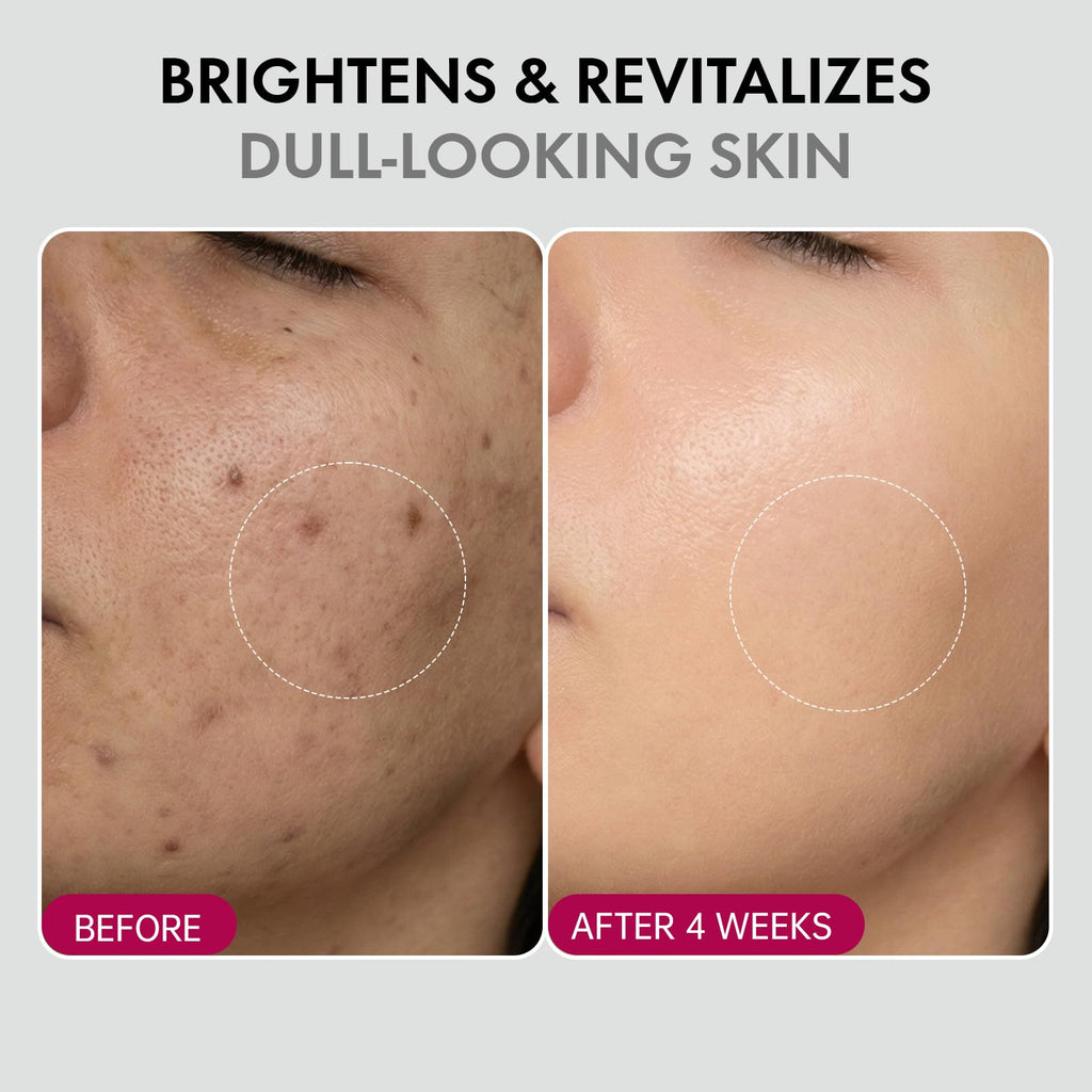 Glopink 2Pcs Arbutin 7% + Tranexamic Acid 4% Cream – Niacinamide Brightening Hydrating Moisturizer