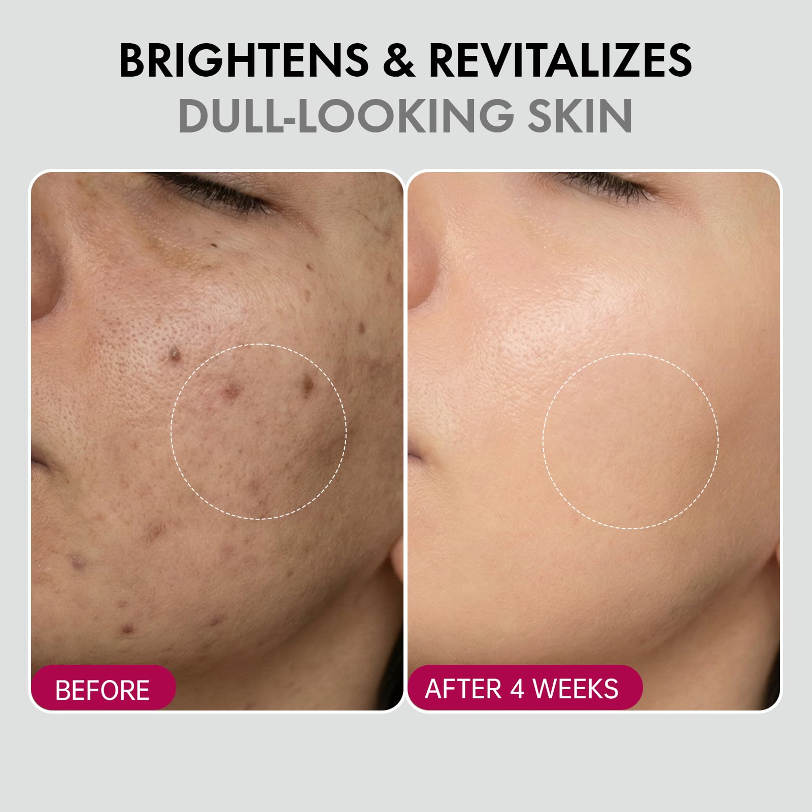 Glopink 2Pcs Arbutin 7% + Tranexamic Acid 4% Cream – Niacinamide Brightening Hydrating Moisturizer