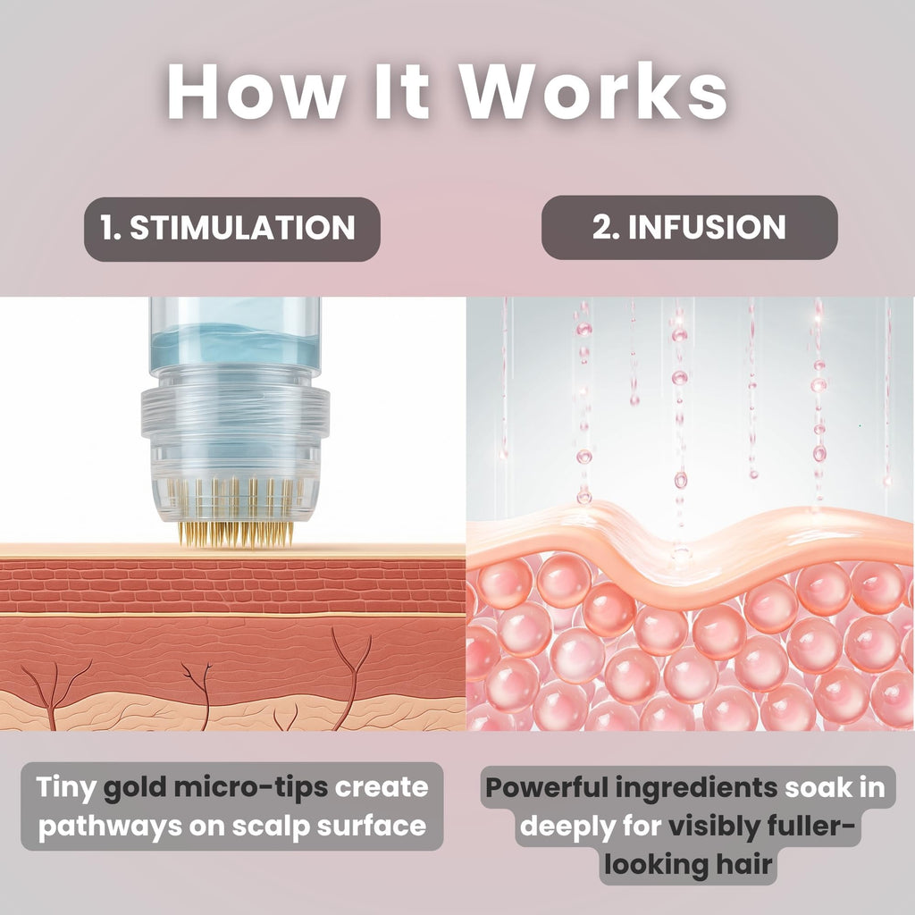 Glov Beauty Micro Infusion Hair Renewal Kit – 0.25mm Gold Derma Stamp & Hyaluronic Acid Serum