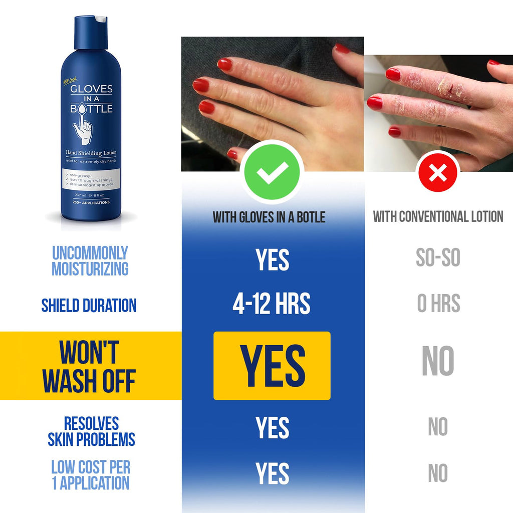 Gloves In A Bottle Shielding Lotion for Dry, Itchy Skin — 8 oz (12 Pack) | Hypoallergenic & USA Made