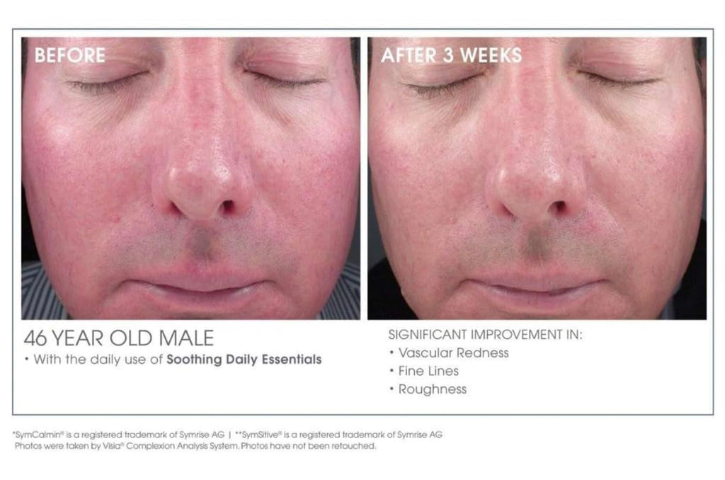 Glowbiotics Calming Restorative Treatment – Probiotic Redness Relief Serum