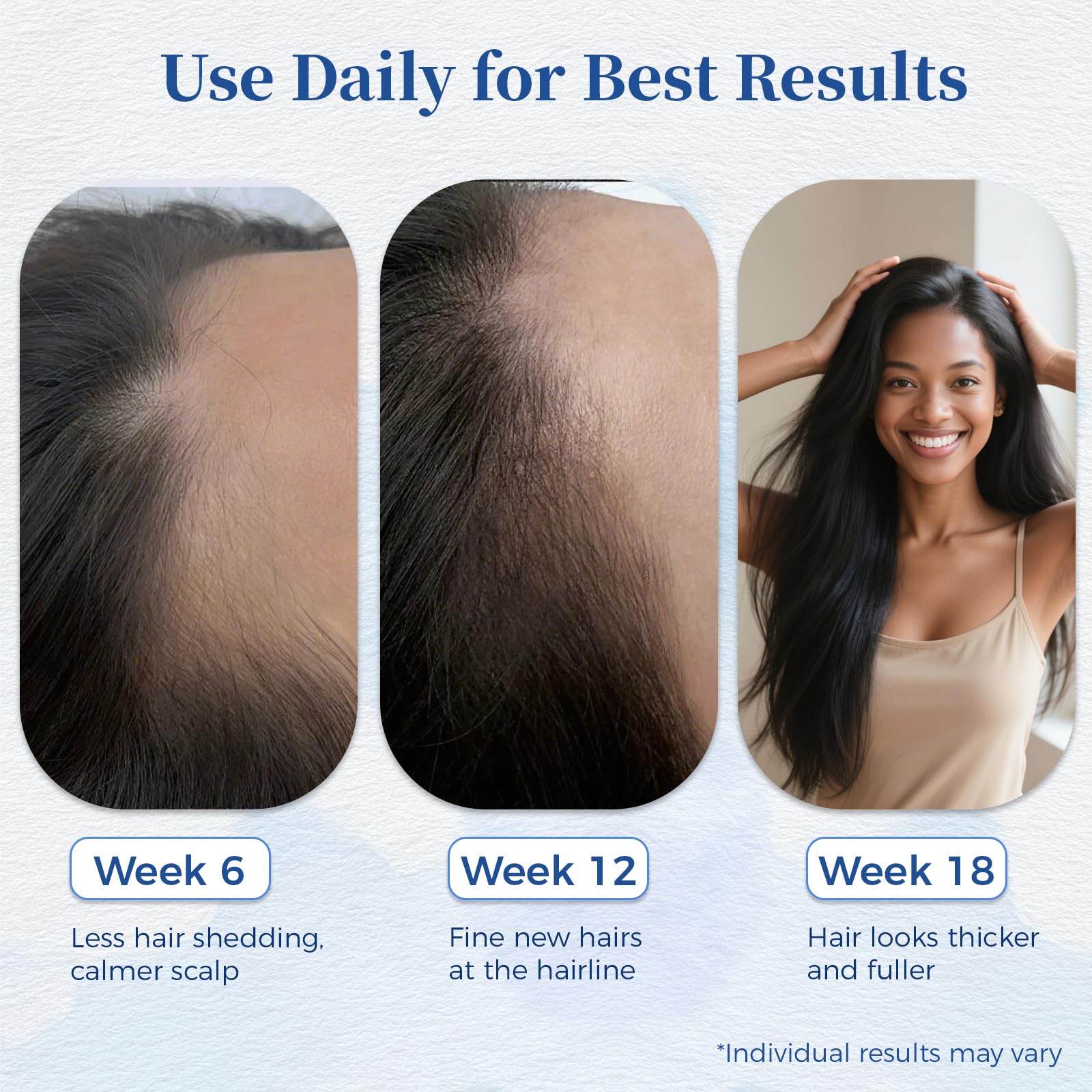 Gluvelessia Hair Growth Serum Roll-On with Rosemary – Thicker, Fuller Hair for Men & Women