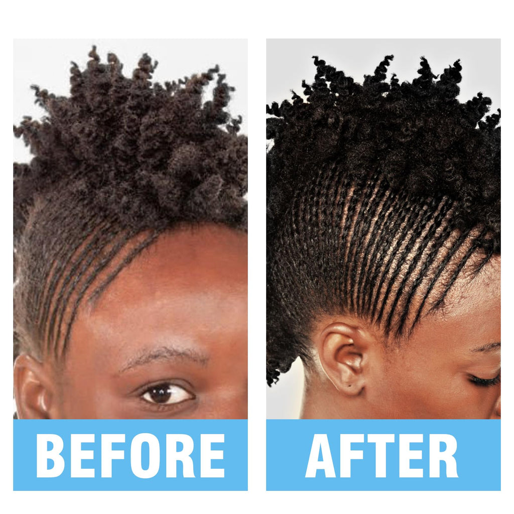 Goiple 10oz Rinse-Free Shampoo for Braids | No-Water Cleanse for Locs, Twists & Weaves