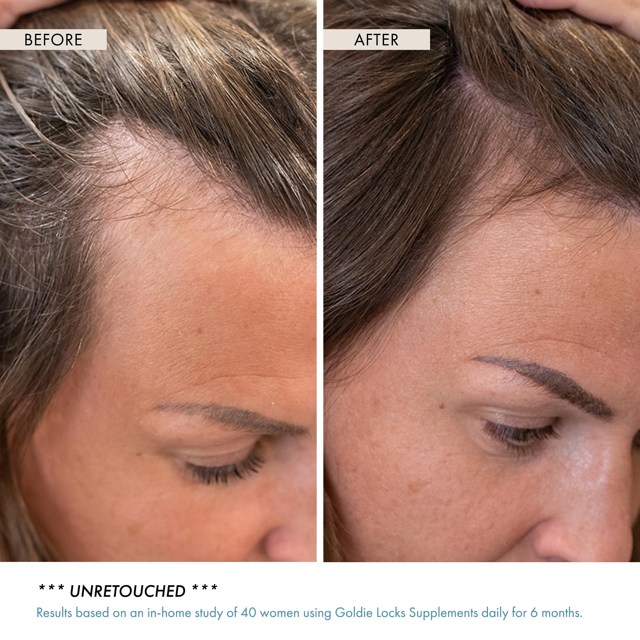 Goldie Locks Hair Growth Supplements - Original Formula for Hair, Skin, Nails & Joints