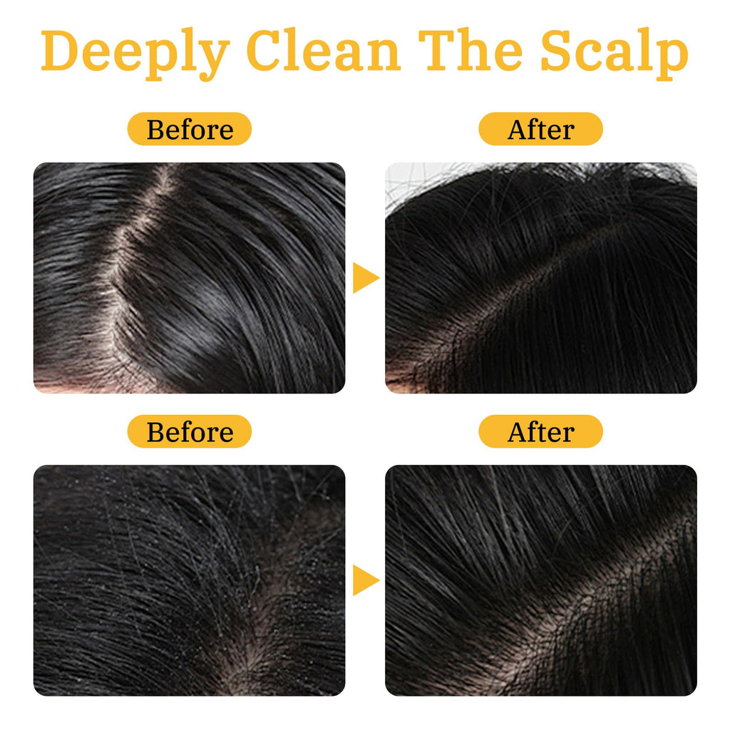 Gray Hair Reverse Bar | Black Soap for Grey Hair – Deep Nourishment