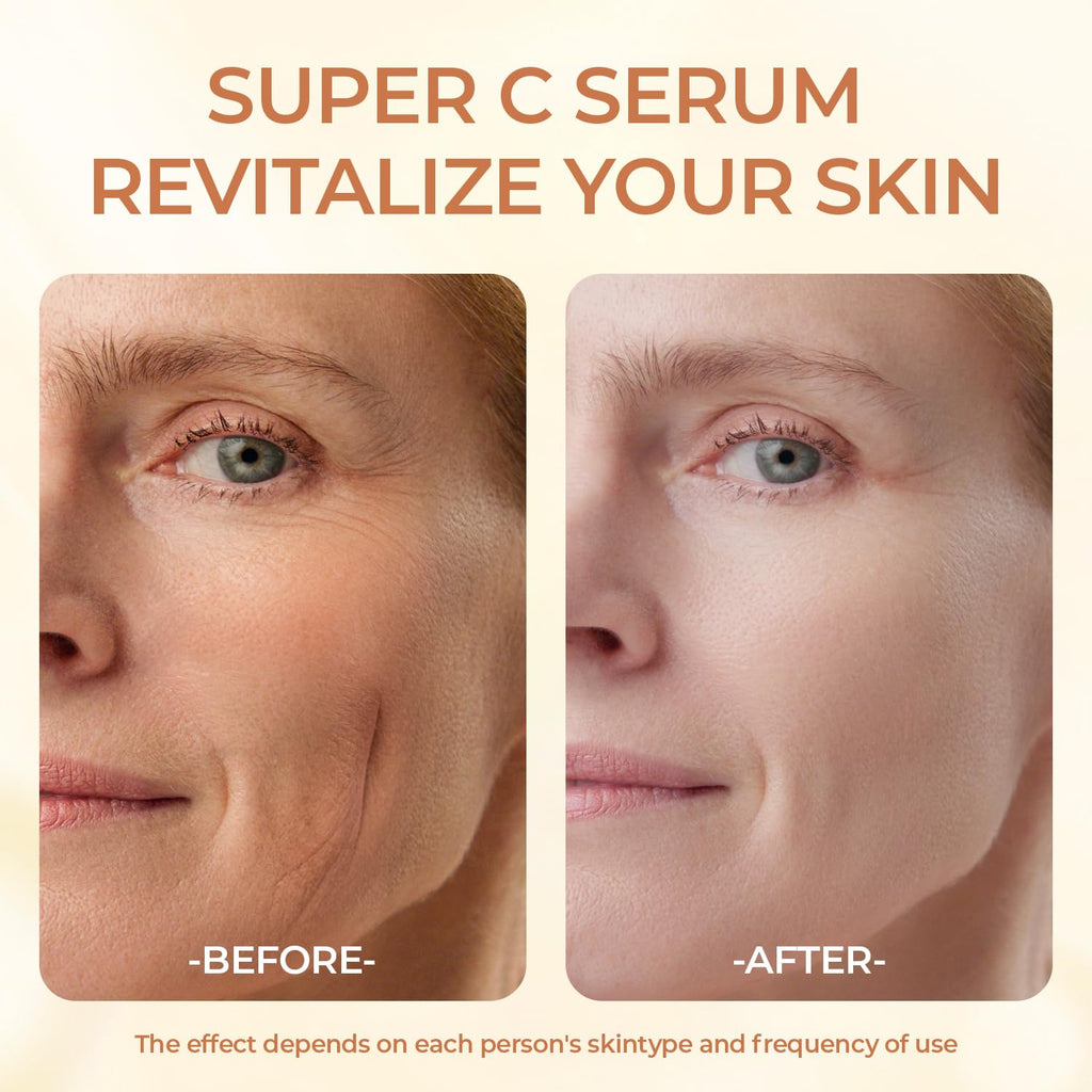 Green Luxe Super Vitamin C Serum for Mature Skin – Hydration & Anti-Aging (1.69 oz)