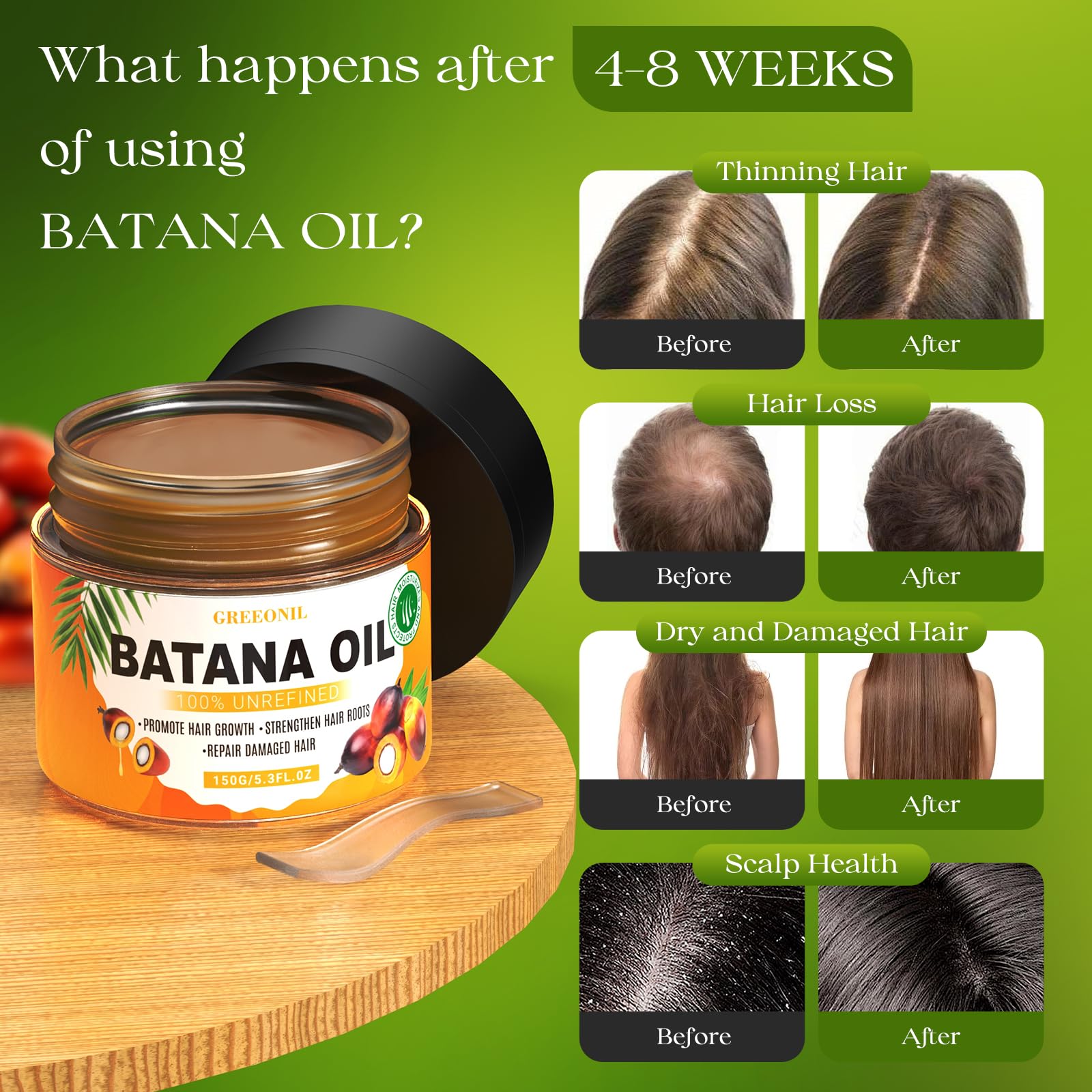 GREEONIL Batana Oil for Hair Growth – 100% Pure, Unrefined Batana Oil (5.3 oz)