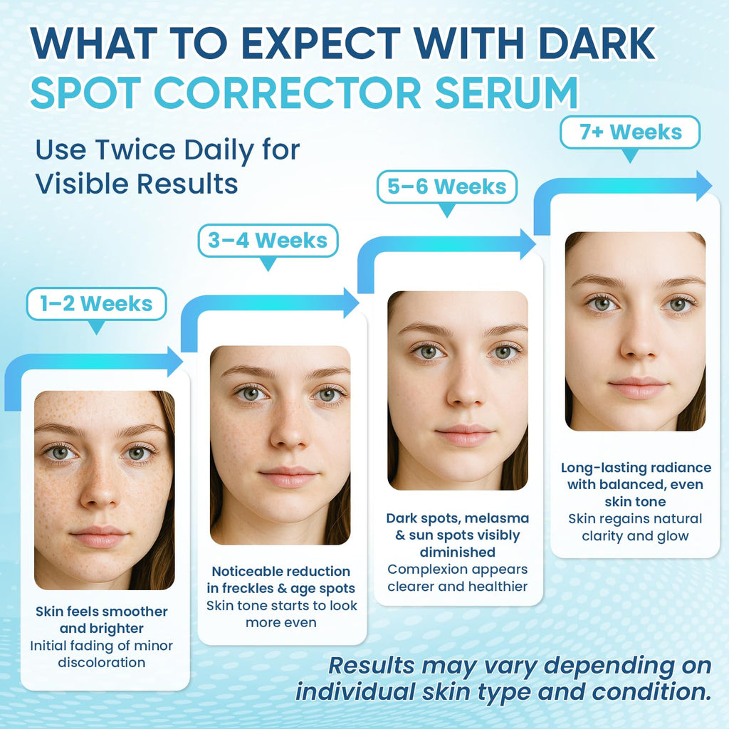 Greoay Dark Spot Remover Serum for Face & Body – Hyperpigmentation Treatment, Brighten & Even Skin Tone, 2 x 1 Fl Oz