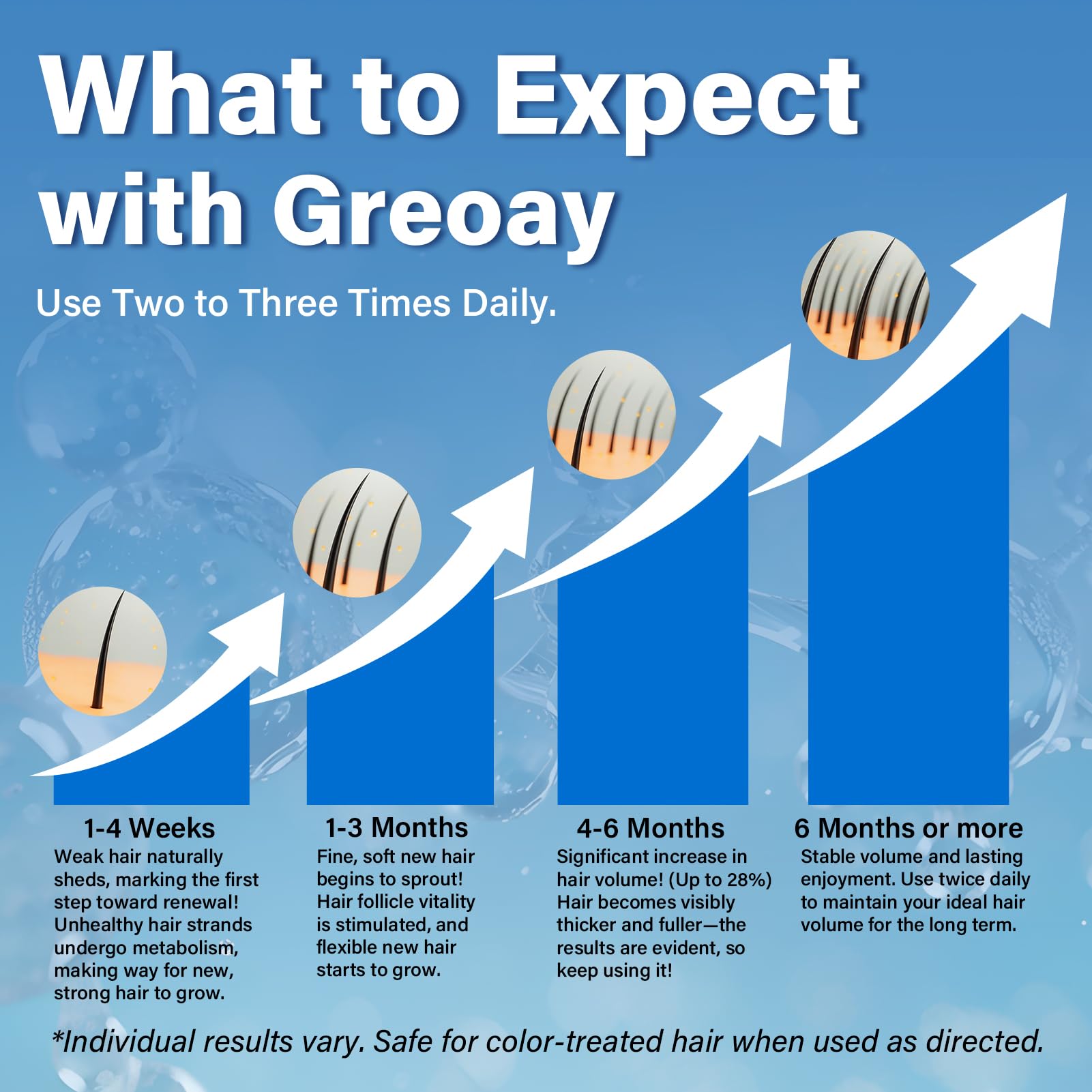 Greoay 5% Minoxidil Hair Growth Foam for Men & Women – Thinning Hair & Receding Hairline