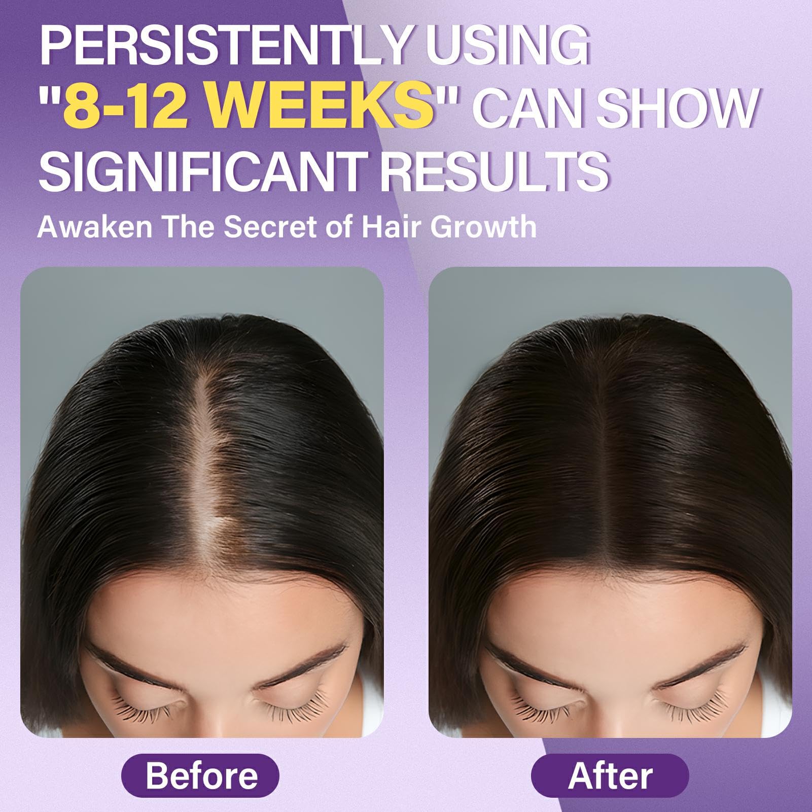 Greoay 5% Minoxidil Foam for Women – Hair Growth for Thinning Hair, Receding Hairline, 3 Bottles (2.11 oz Each)