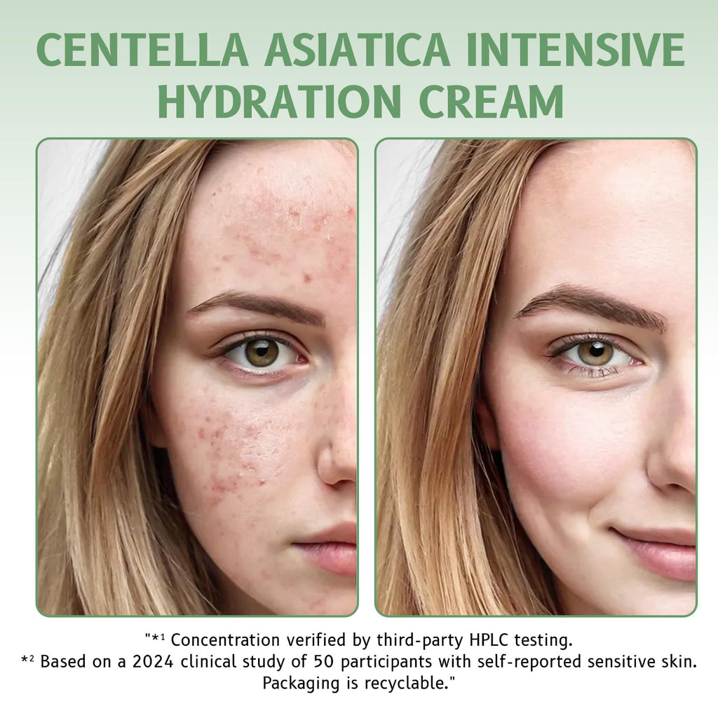 GROEI Centella Asiatica Intensive Hydration Cream - 85% Natural Ingredients | 50g