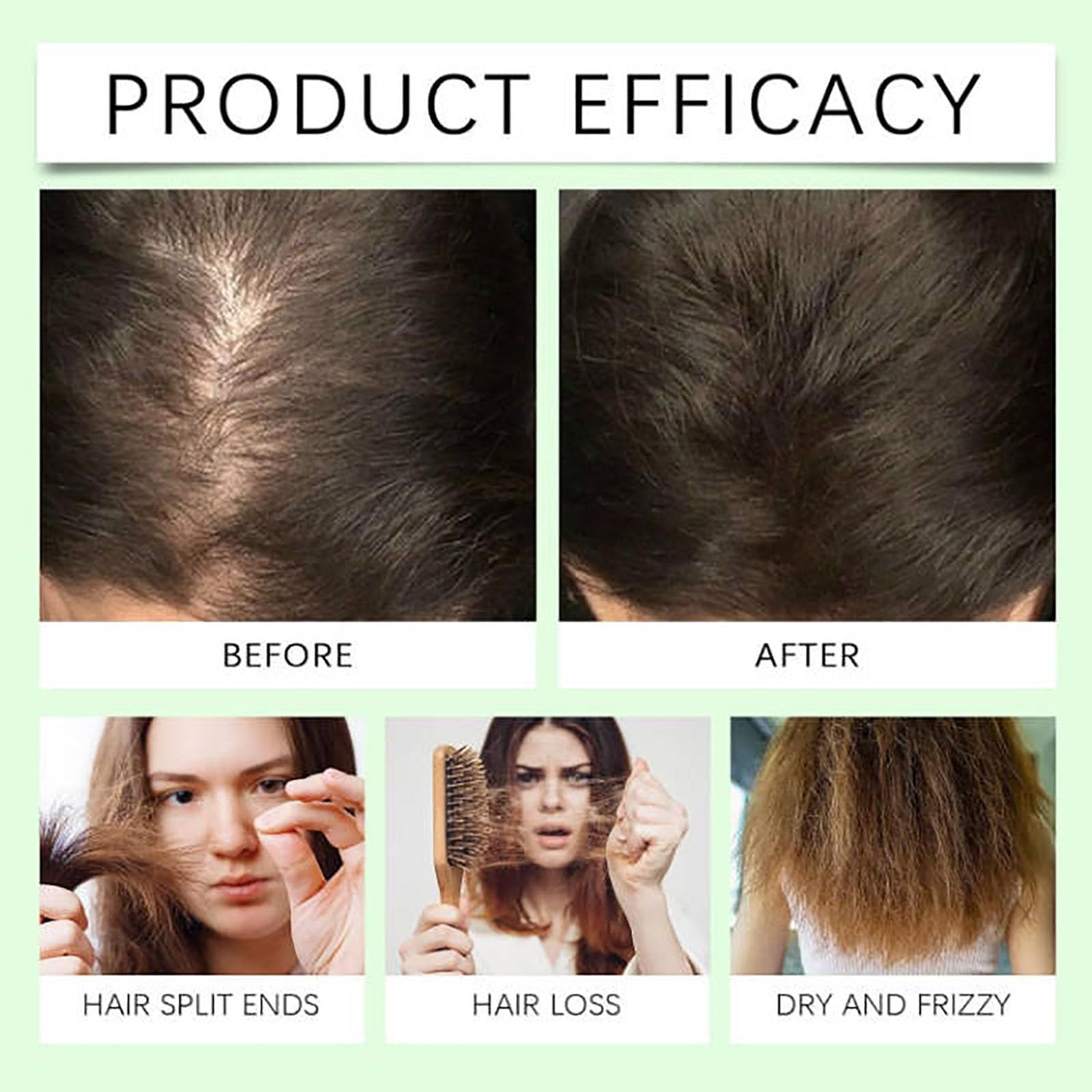 Grospe Anti-Hair Fall Shampoo | Nourishing Botanical Blend for All Hair Types – 3.52 oz