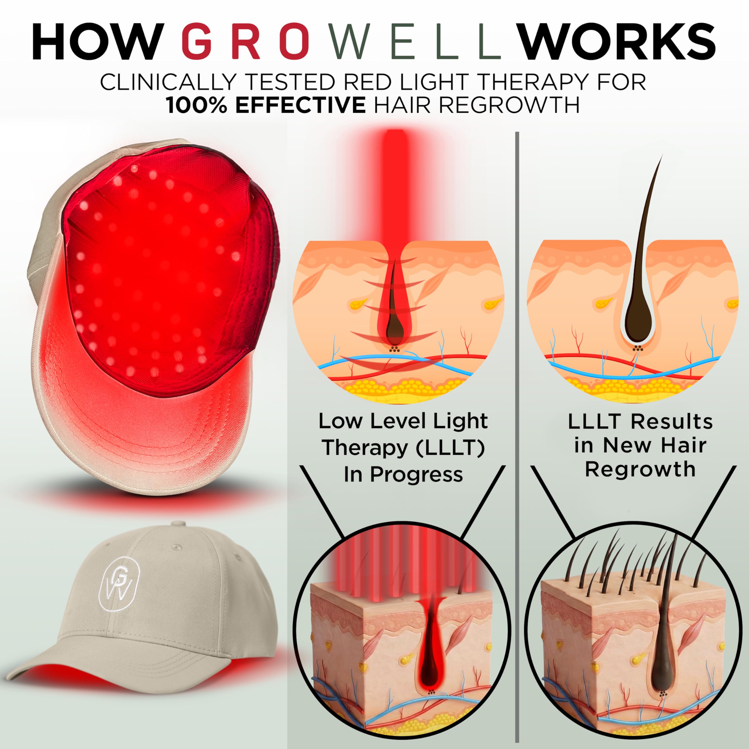 GroWell Red Light Therapy Hair Growth Cap – FDA-Cleared Laser & LED Hair Regrowth (Beige)