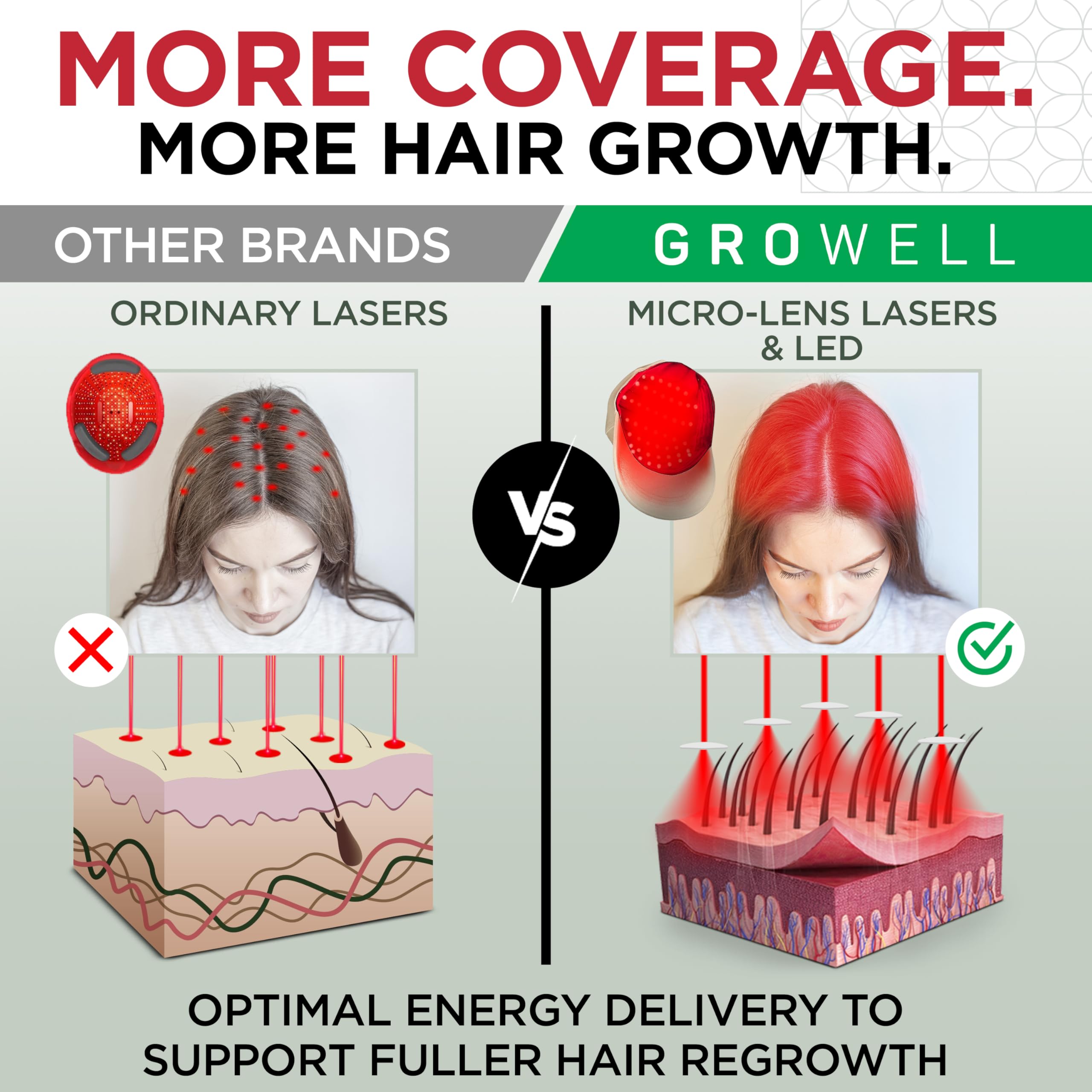 GroWell Red Light Therapy Hair Growth Cap – FDA-Cleared Laser & LED Hair Regrowth (Beige)