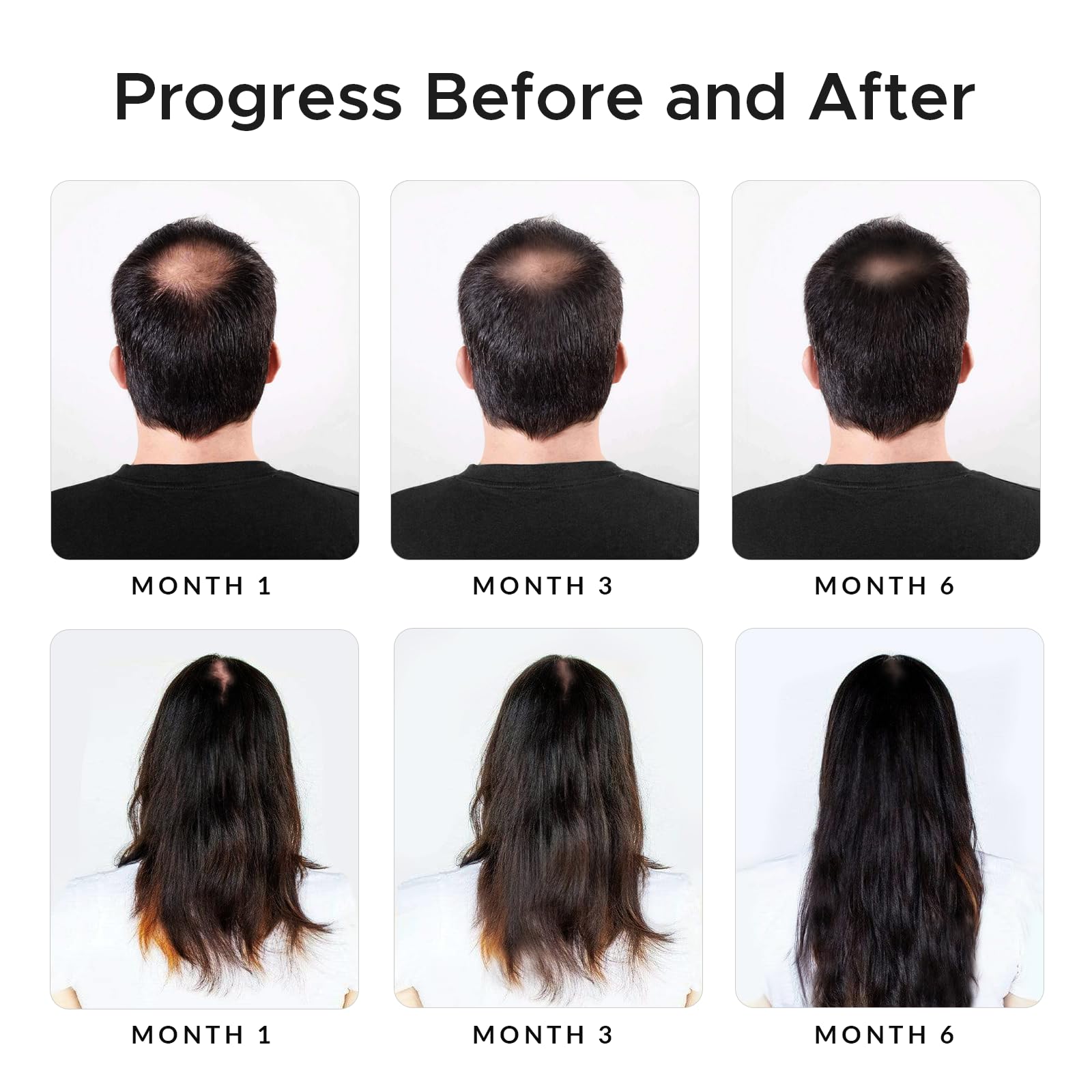 Growth Essence Minoxidil & Biotin Shampoo for Hair Growth – DHT Blocker & Nourishing Formula