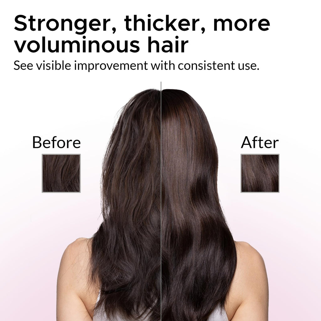 Growth Essence Minoxidil Shampoo for Women – 2% Regrowth Formula with Biotin, Caffeine & DHT Blockers
