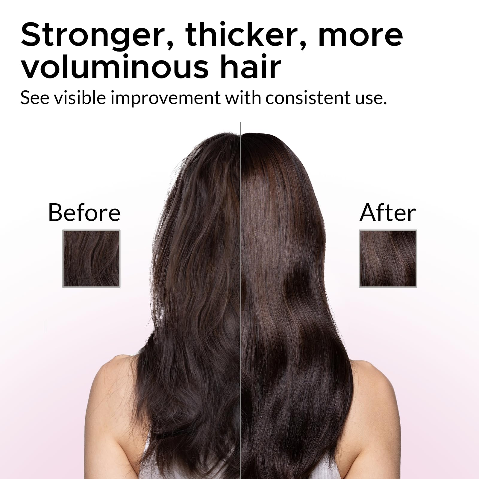 Growth Essence Minoxidil Shampoo for Women – 2% Regrowth Formula with Biotin, Caffeine & DHT Blockers