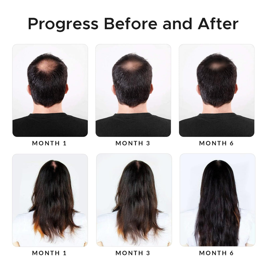 Growth Essence Twopack Thickening Hair Regrowth Shampoo – Minoxidil & Biotin