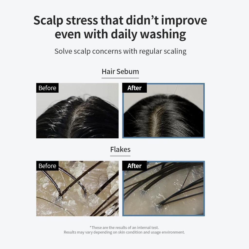 GROWUS Sea Salt Therapy Scalp Scaler — 2-in-1 Shampoo for Itchy & Oily Scalp | Salicylic Acid, Niacinamide, Dexpanthenol | 8.8 oz / 250 g | Paraben & Sulfate Free