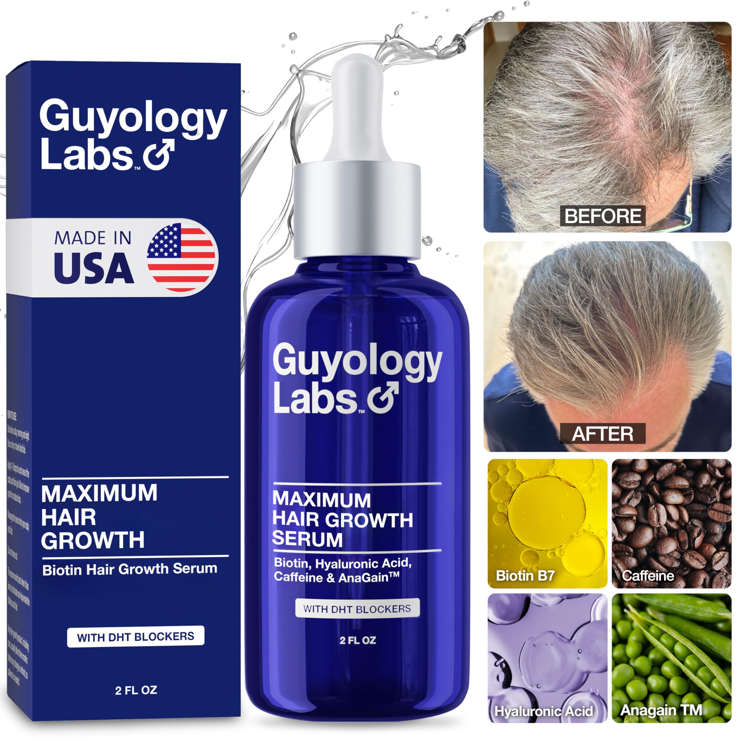Guyology Labs Hair Growth Serum – 4% AnaGain™, Biotin & Caffeine | Dermatologist Recommended