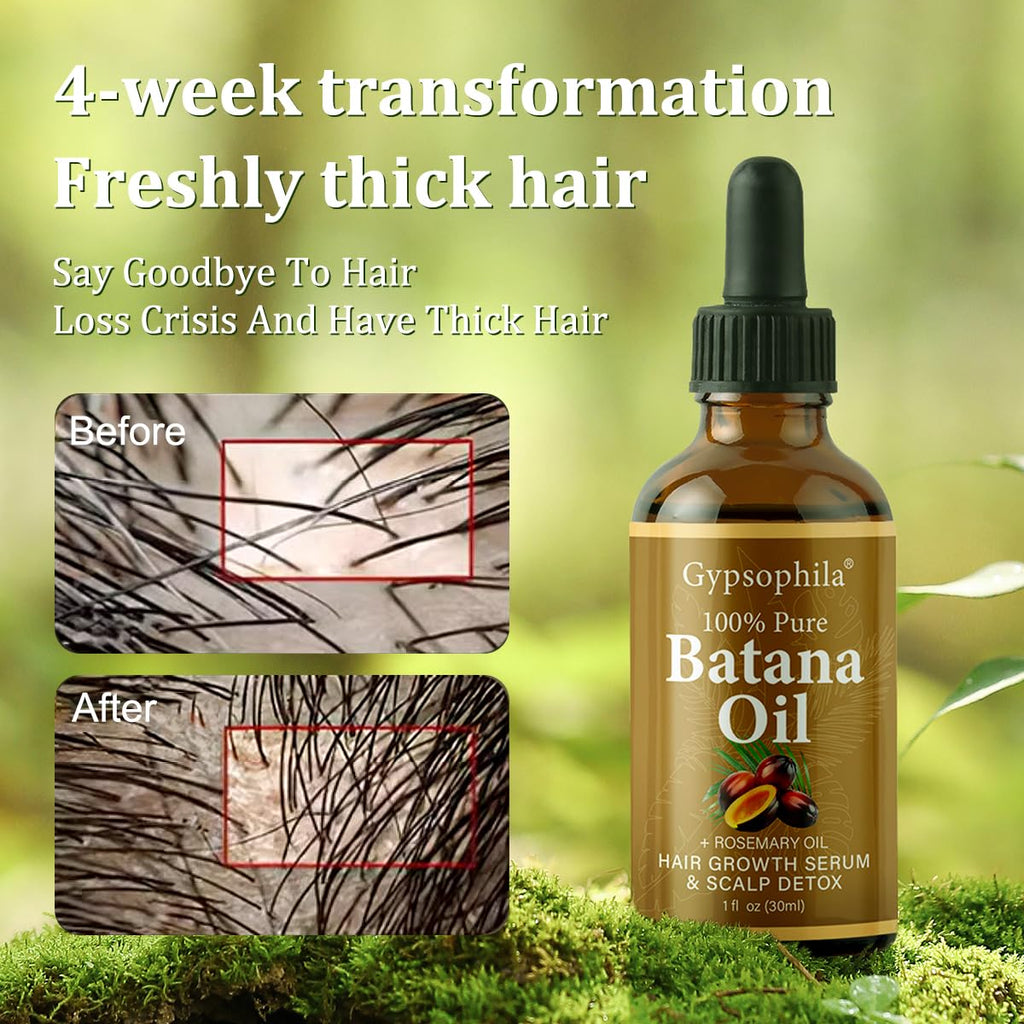 Gypsophila Batana Oil for Hair Growth – 100% Pure, Scalp Nourishment, Breakage Reduction (1 Fl Oz)