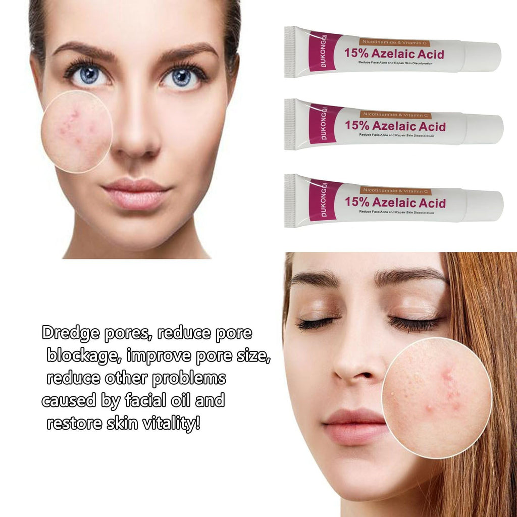gzchaox Azelaic Acid Cream – 15% Facial Care Essence, 20g for Acne and Redness
