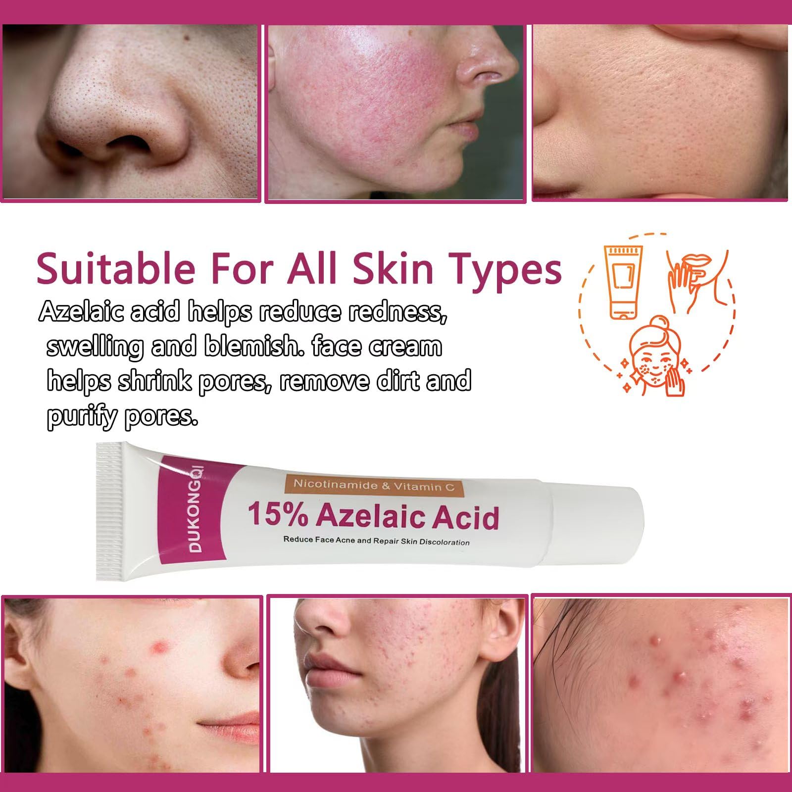 gzchaox Azelaic Acid Cream – 15% Facial Care Essence, 20g for Acne and Redness