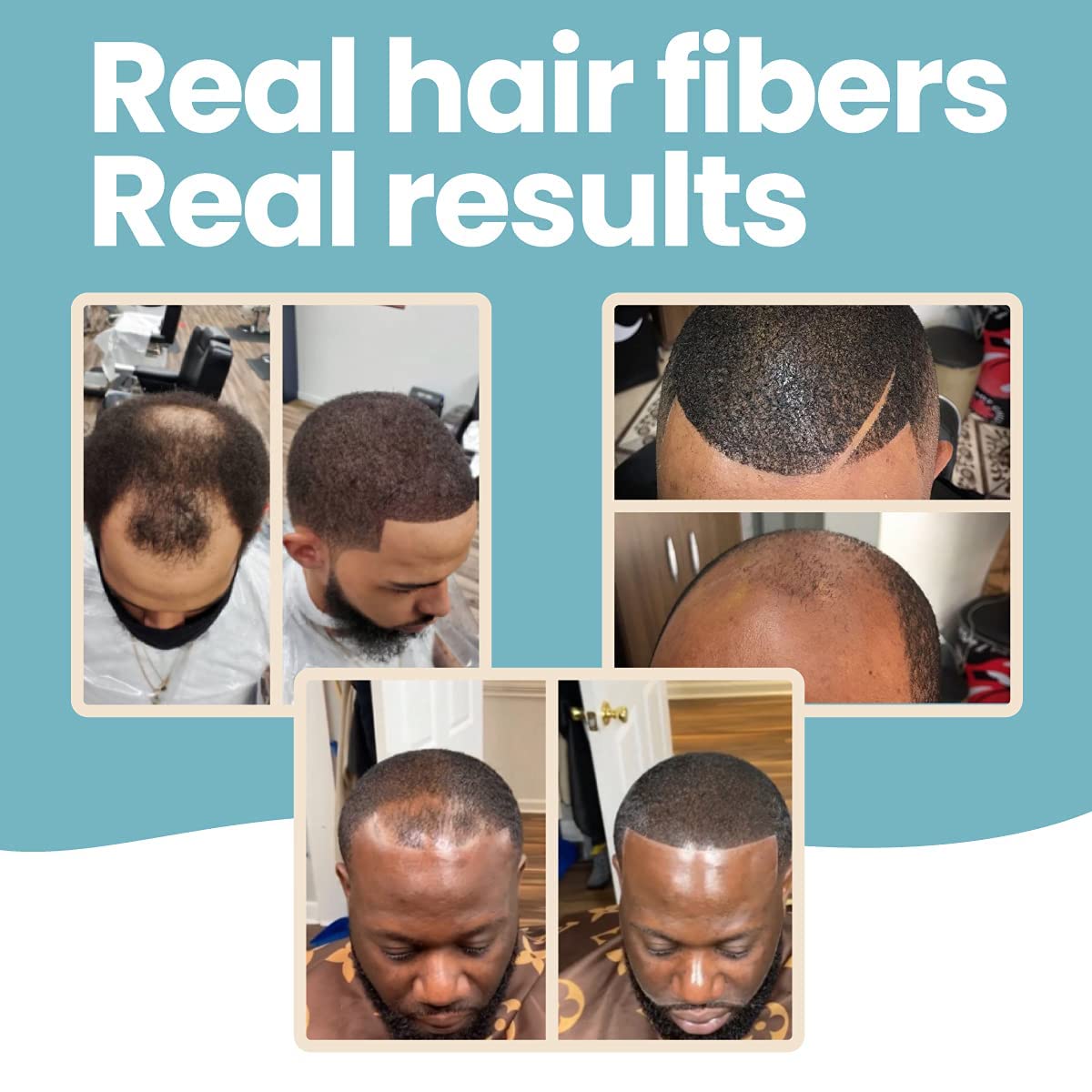 Hair Illusion Black Real Hair Fibers – 2-Pack (38g Each) for Thinning Hair – Natural, Non-Synthetic Coverage