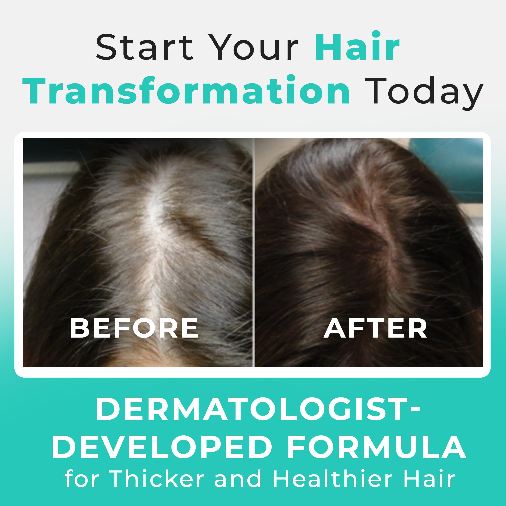 Hair Plus MD Hair Growth Supplement – 120 Capsules for Fuller, Denser Hair | Dermatologist-Developed Formula