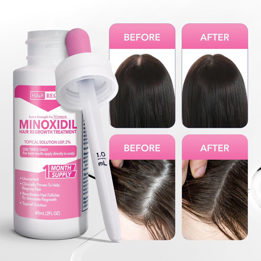 Hair Regen 2% Minoxidil for Women – Extra Strength Topical Solution (6 Pack)