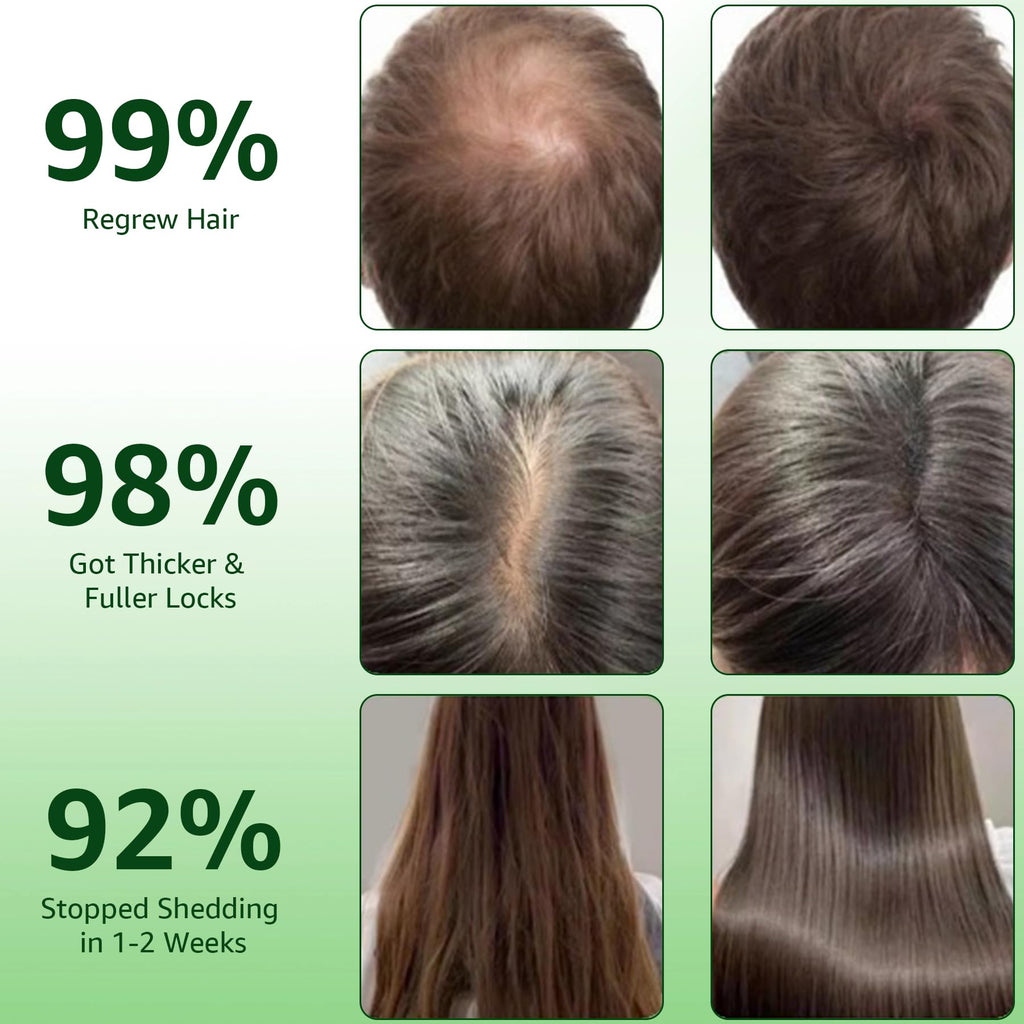 Hair Regrowth System | Advanced Biotin & Ginseng Serum for Thicker Hair