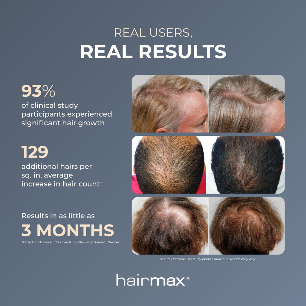Hairmax Ultima 12 LaserComb – FDA Cleared Cordless Hair Growth Device