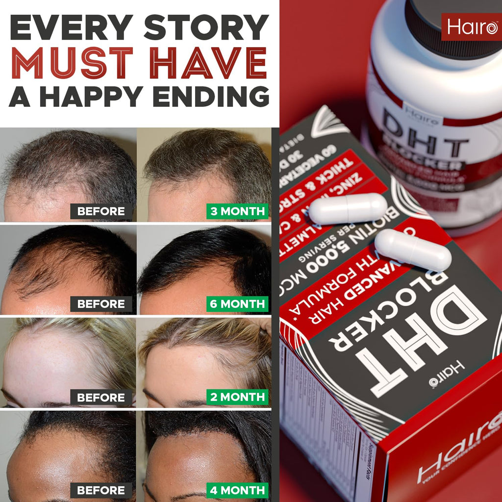 DHT Blocker Hair Growth Supplement – Biotin & Saw Palmetto for Regrowth (Unisex)
