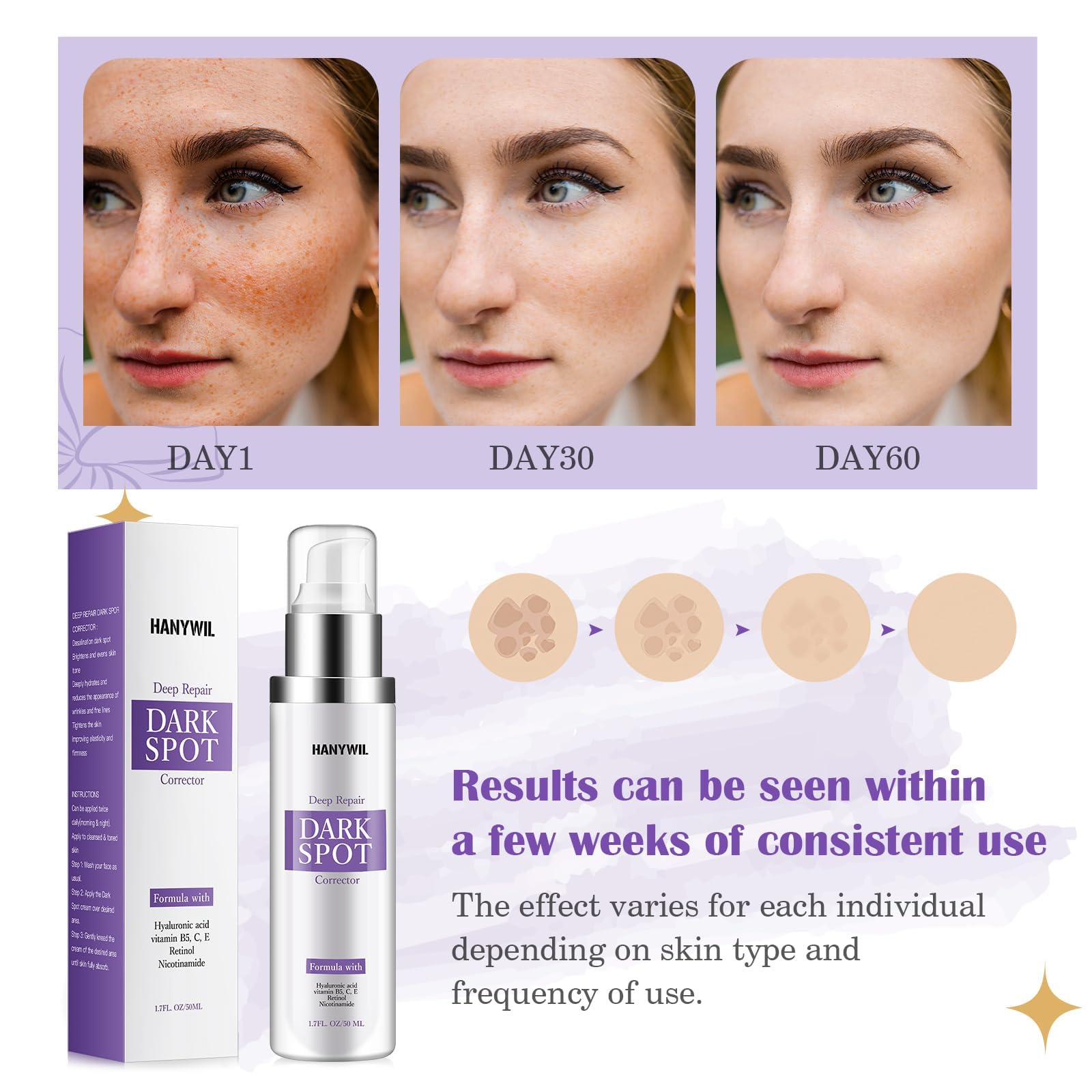 HANYWIL Dark Spot Serum with Retinol & Niacinamide – Even Tone, 1.7 fl oz