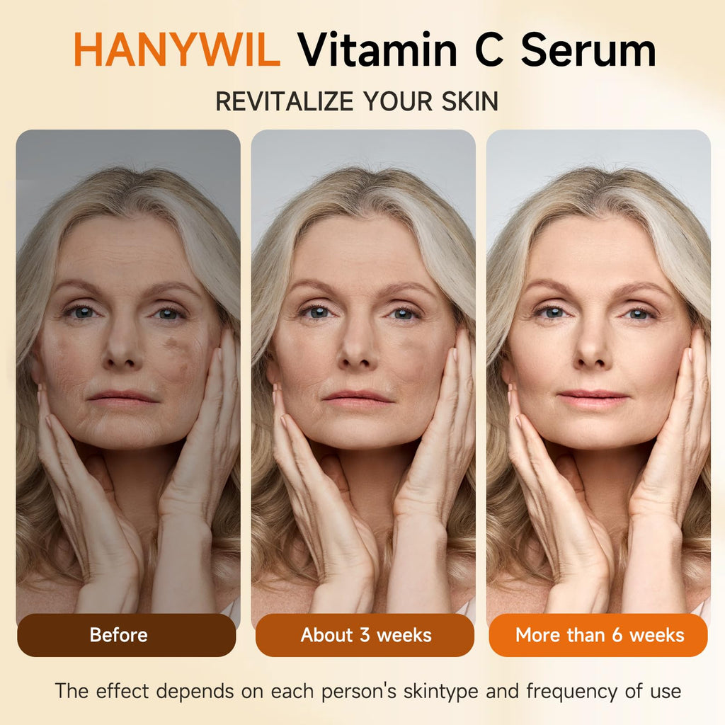 HANYWIL 20% Vitamin C Serum for Mature Skin — Target Age Spots & Wrinkles