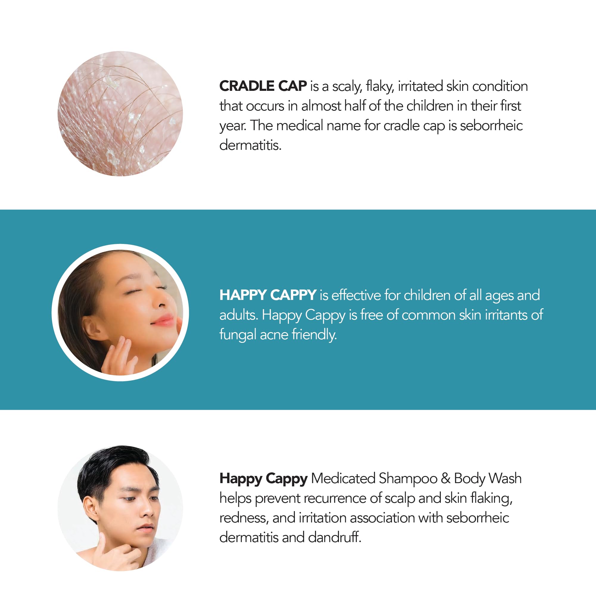 Happy Cappy Medicated Shampoo & Body Wash – Fragrance-Free for Cradle Cap & Dandruff (4 x 8 oz)