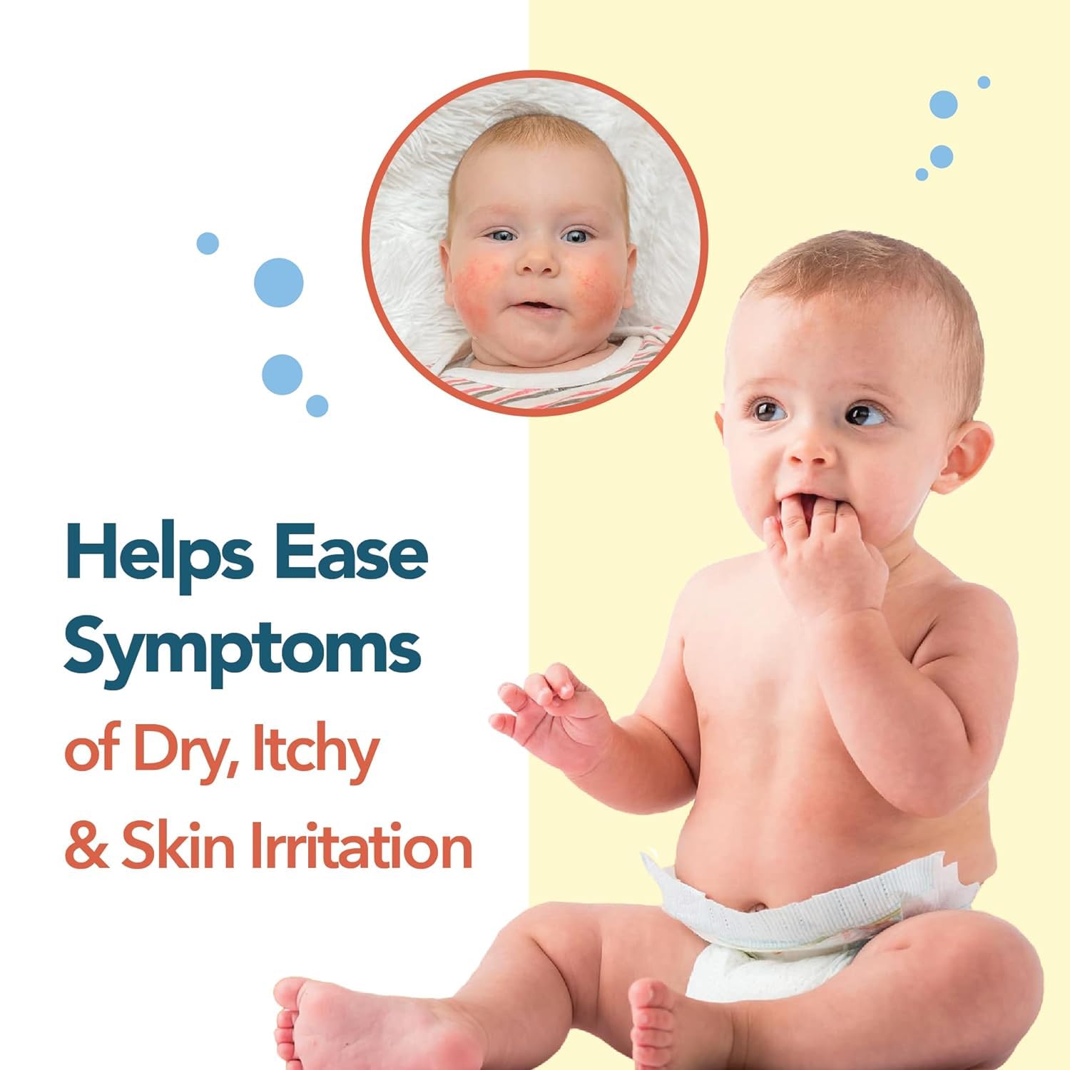 Happy Cappy Medicated & Daily Shampoo + Beanie Brush Bundle — Fragrance-Free for Cradle Cap & Dry Skin