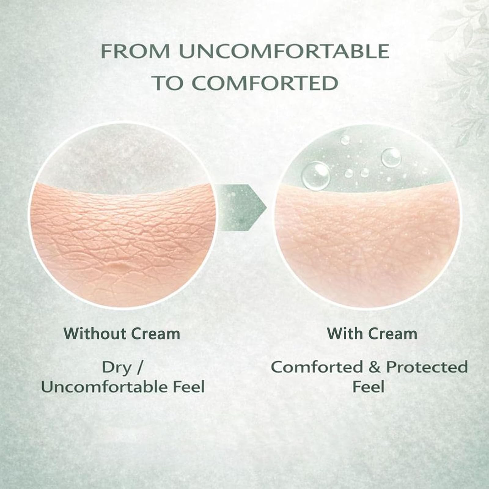 Hea Lora Intertrigo Cream – Skin Fold Care with Zinc Oxide & Undecylenic Acid | Non-Steroid (2PCS)