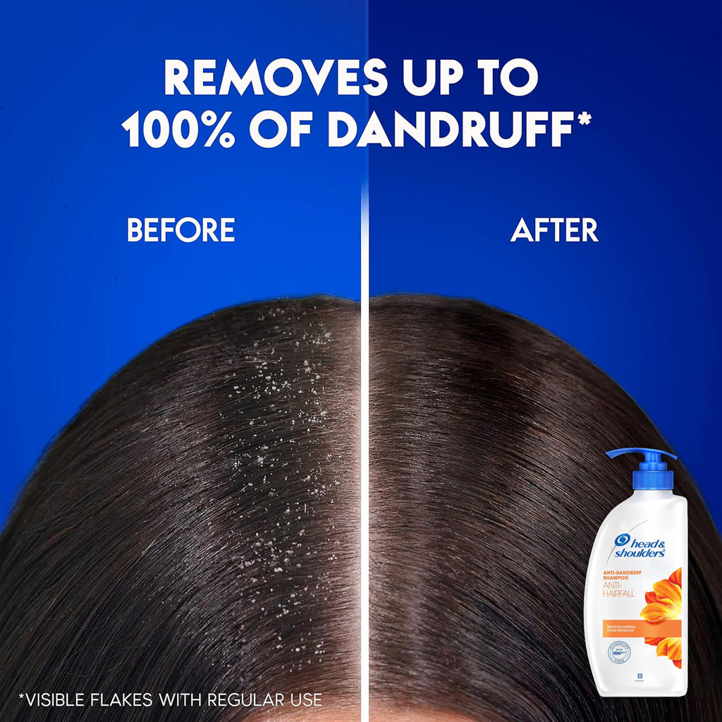 Head & Shoulders Anti Hair Fall Shampoo – 2-Pack Anti Dandruff, 22 oz Pump Bottles