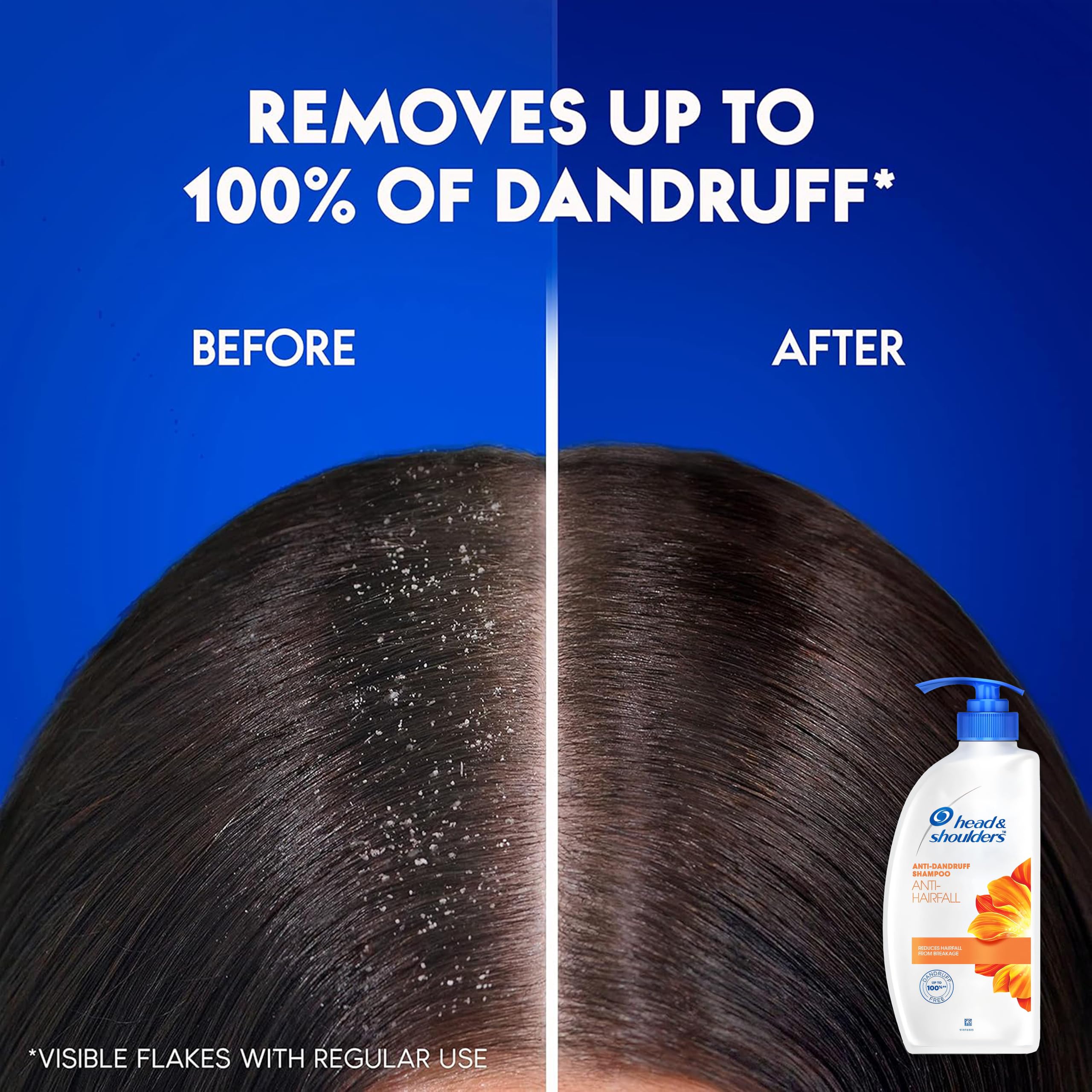 Head & Shoulders Anti Hair Fall Shampoo – 2-Pack Anti Dandruff, 22 oz Pump Bottles