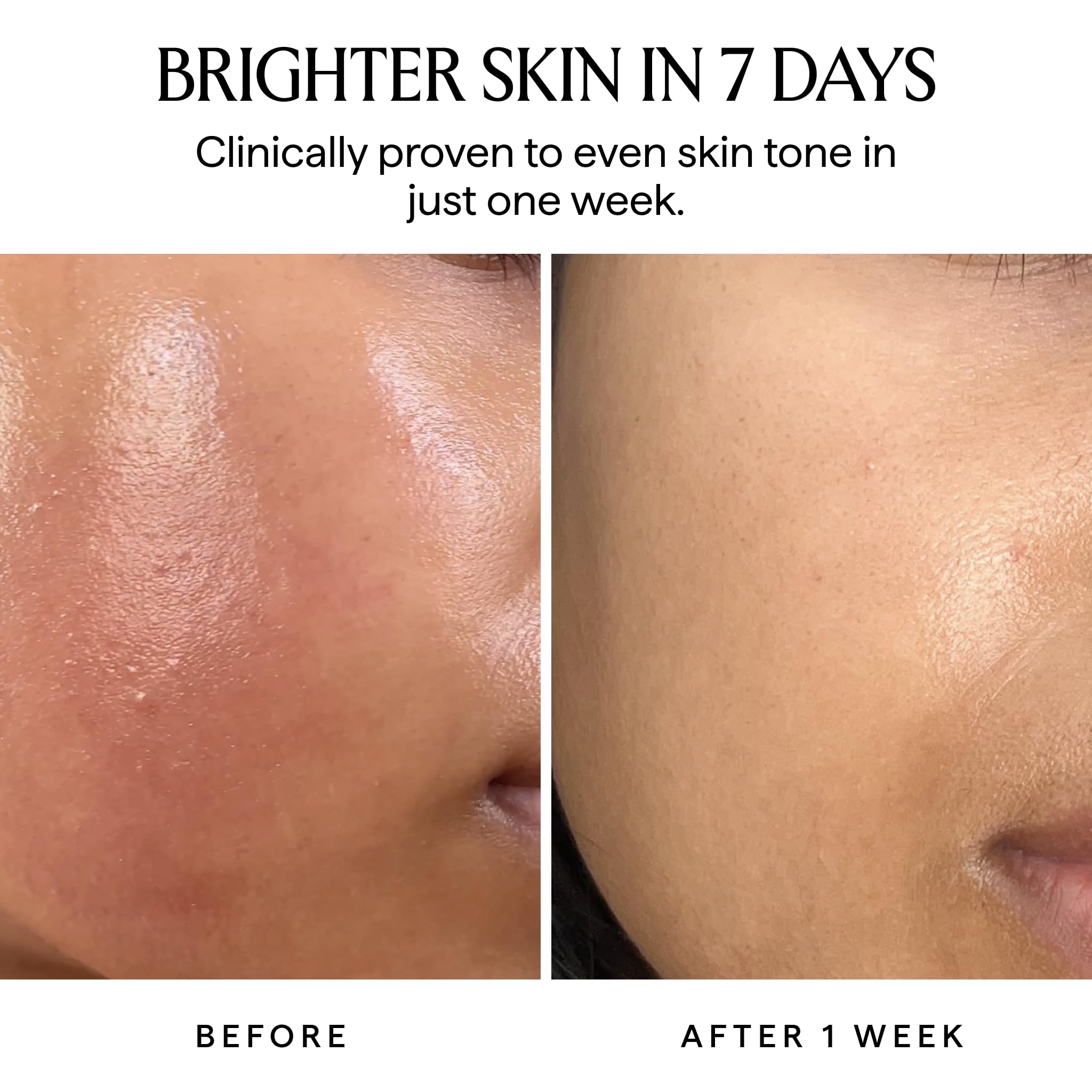 HERBIVORE Nova 15% THD Vitamin C + Turmeric Serum – Brightening for Dark Spots | Vegan, Cruelty-Free, 30 mL