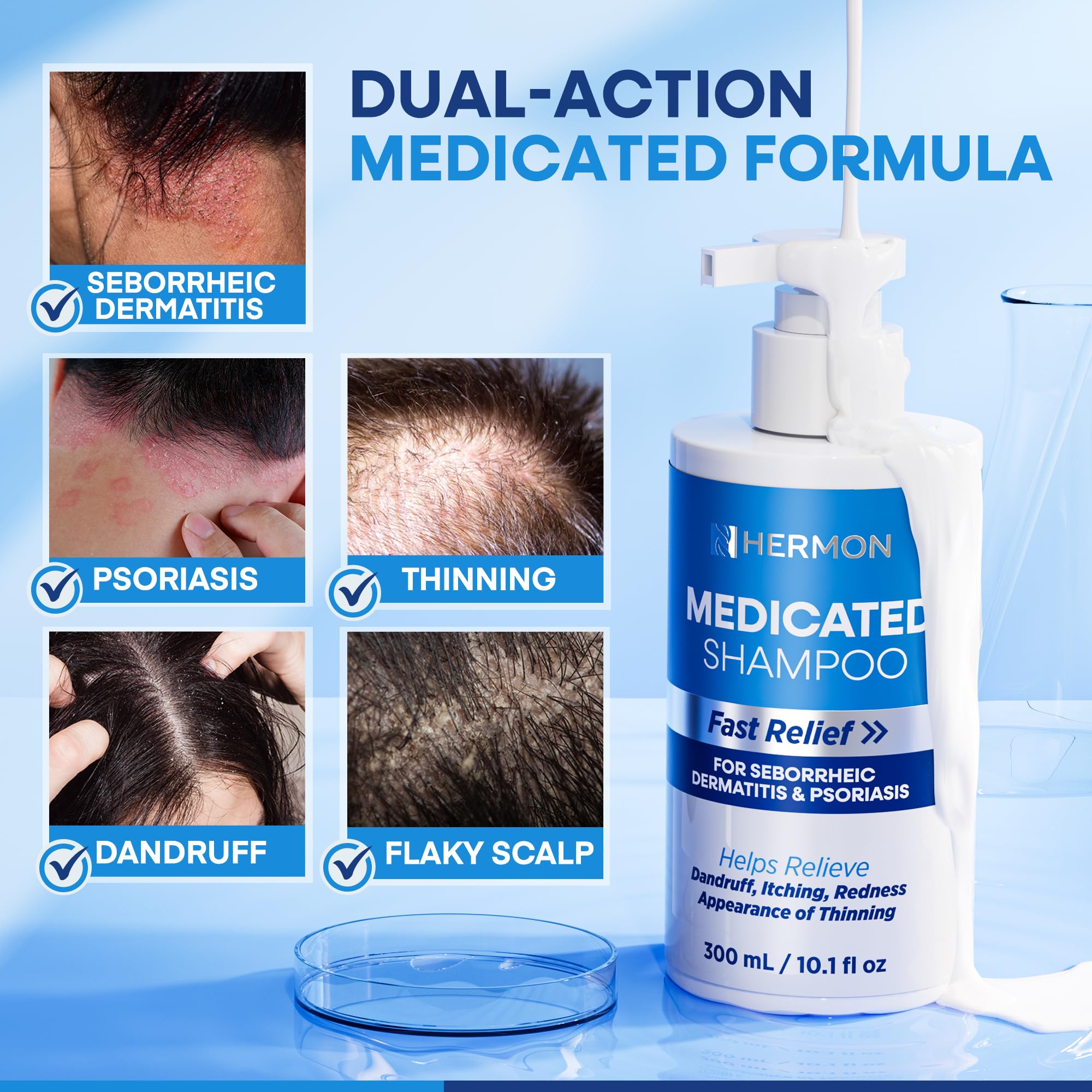 Hermon Medicated Shampoo for Scalp Seborrheic Dermatitis & Psoriasis – Plant-Based Formula, 300ml