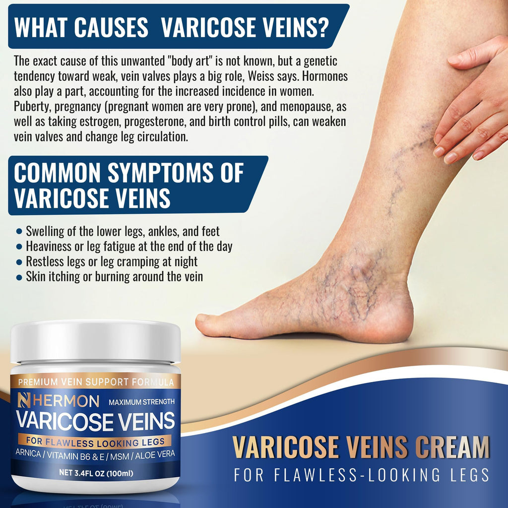 Hermon Varicose & Spider Veins Cream – Natural Circulation Support, Soothing Leg Care (3.4 oz)