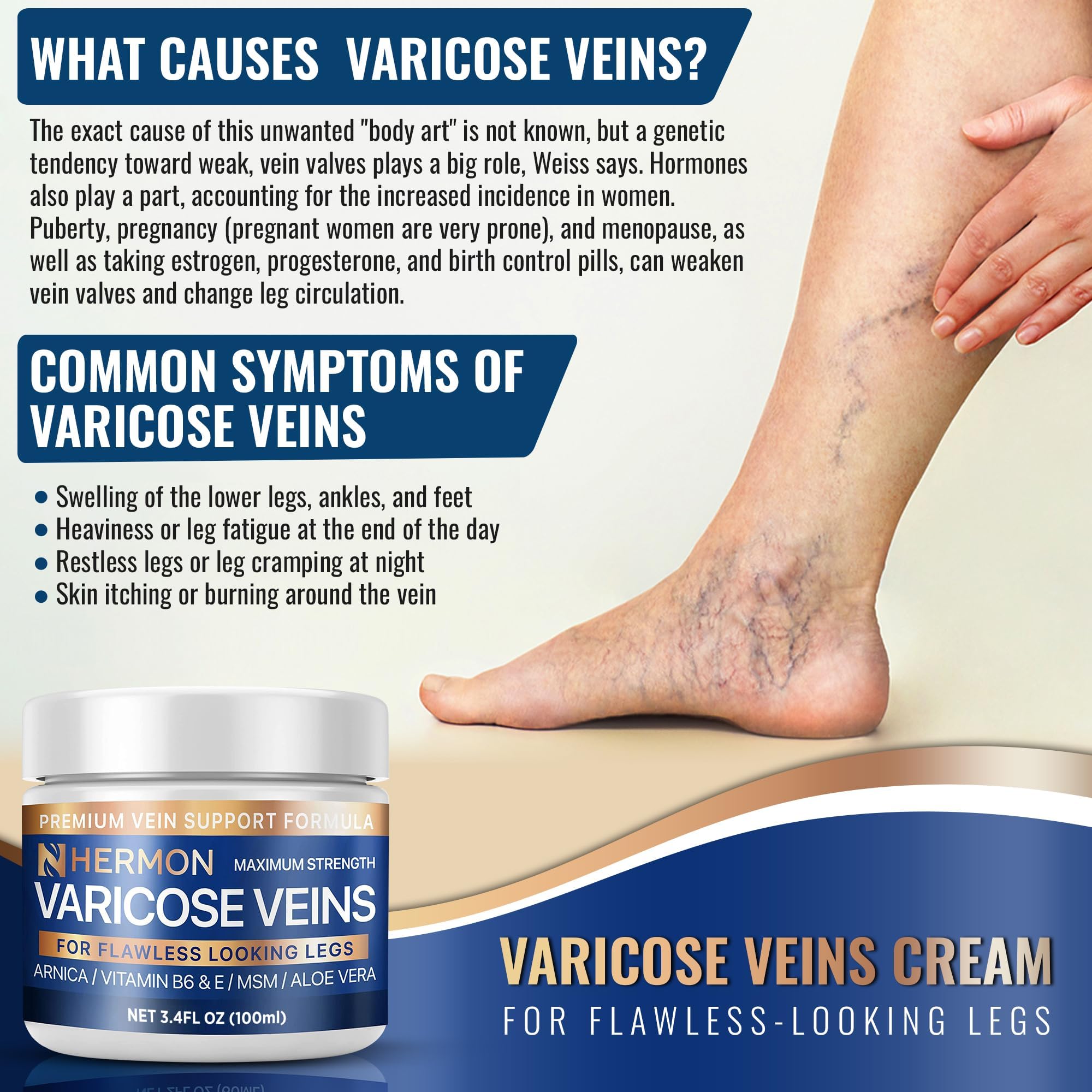 Hermon Varicose & Spider Veins Cream – Natural Circulation Support, Soothing Leg Care (3.4 oz)
