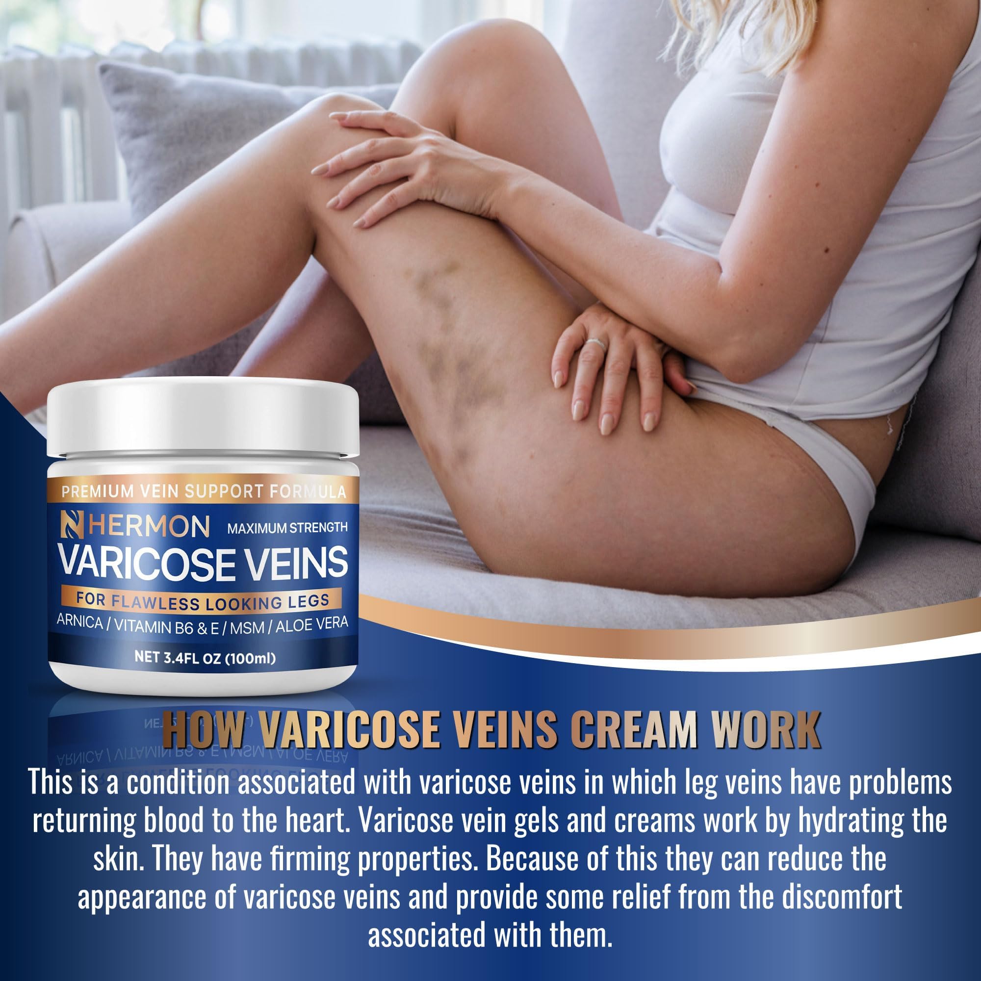 Hermon Varicose & Spider Veins Cream – Natural Circulation Support, Soothing Leg Care (3.4 oz)